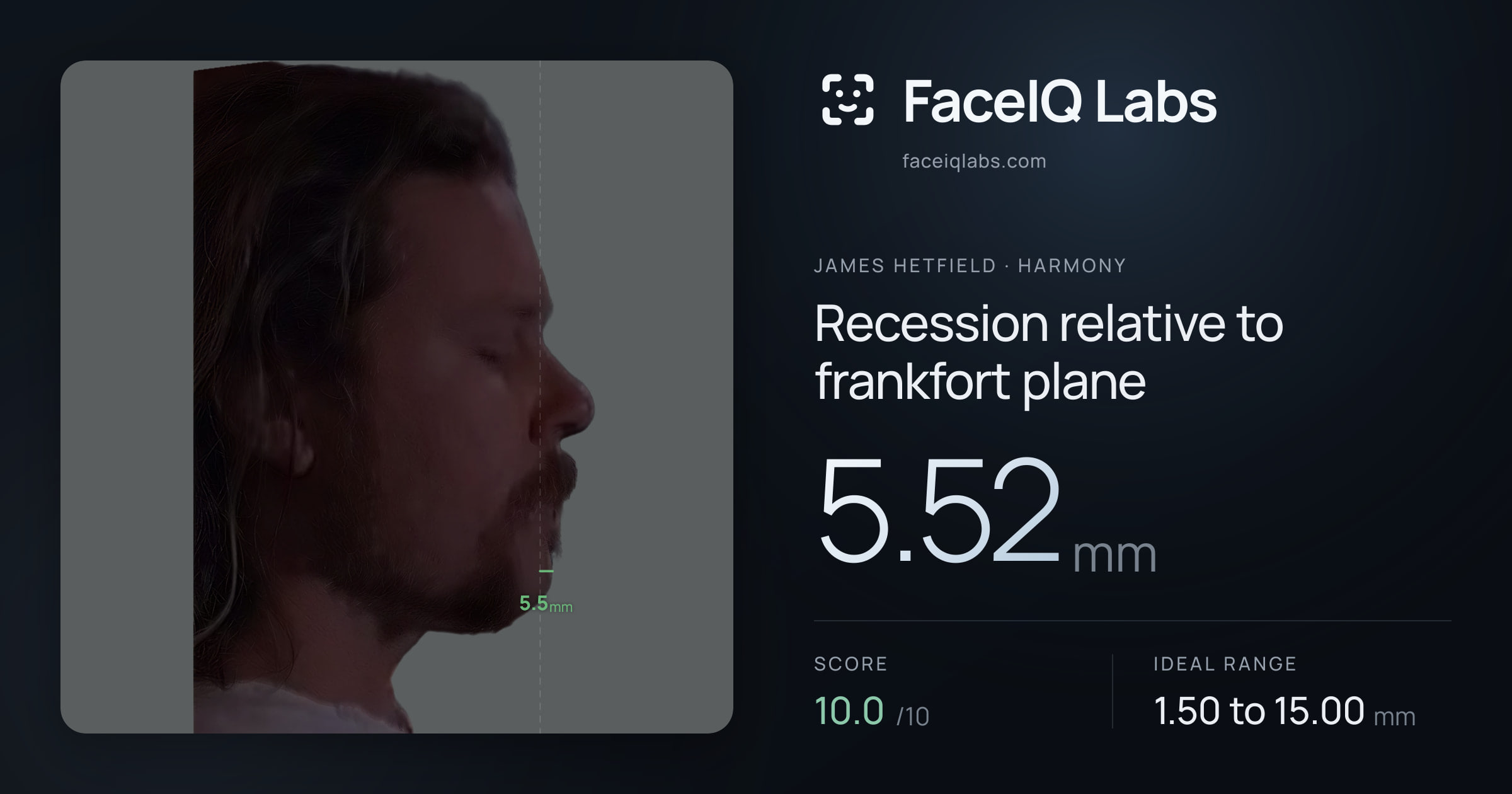James Hetfield Recession relative to frankfort plane: 5.52mm, drawn on the photo