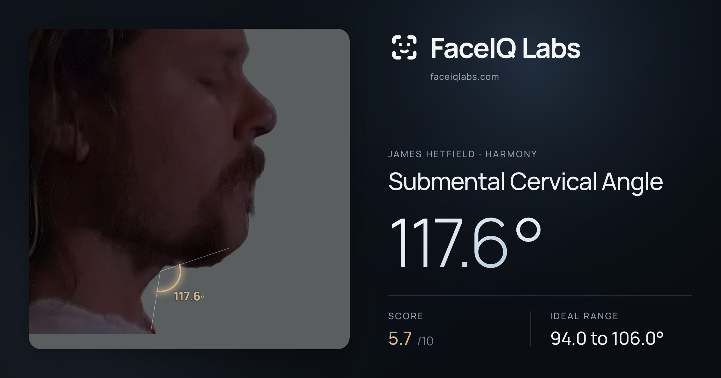 James Hetfield Submental Cervical Angle: 117.6°, drawn on the photo