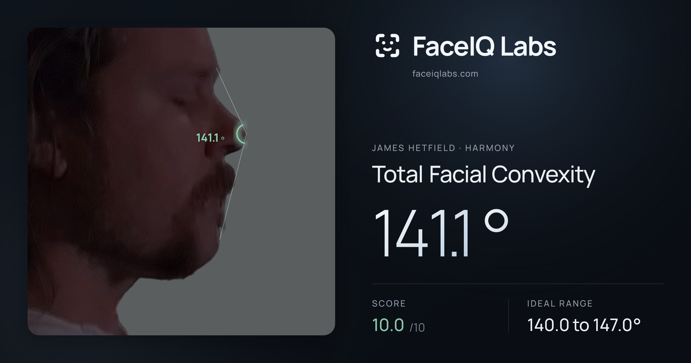 James Hetfield Total Facial Convexity: 141.1°, drawn on the photo
