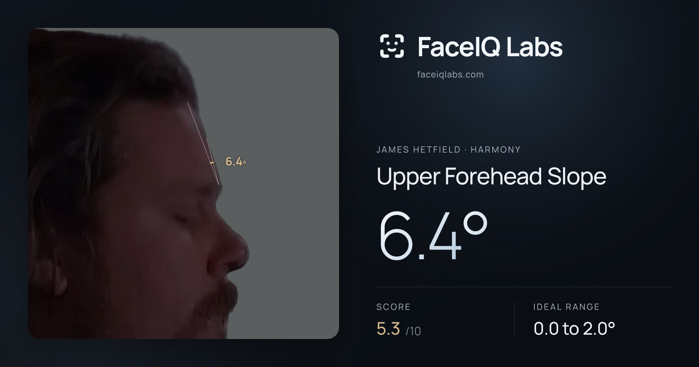 James Hetfield Upper Forehead Slope: 6.4°, drawn on the photo