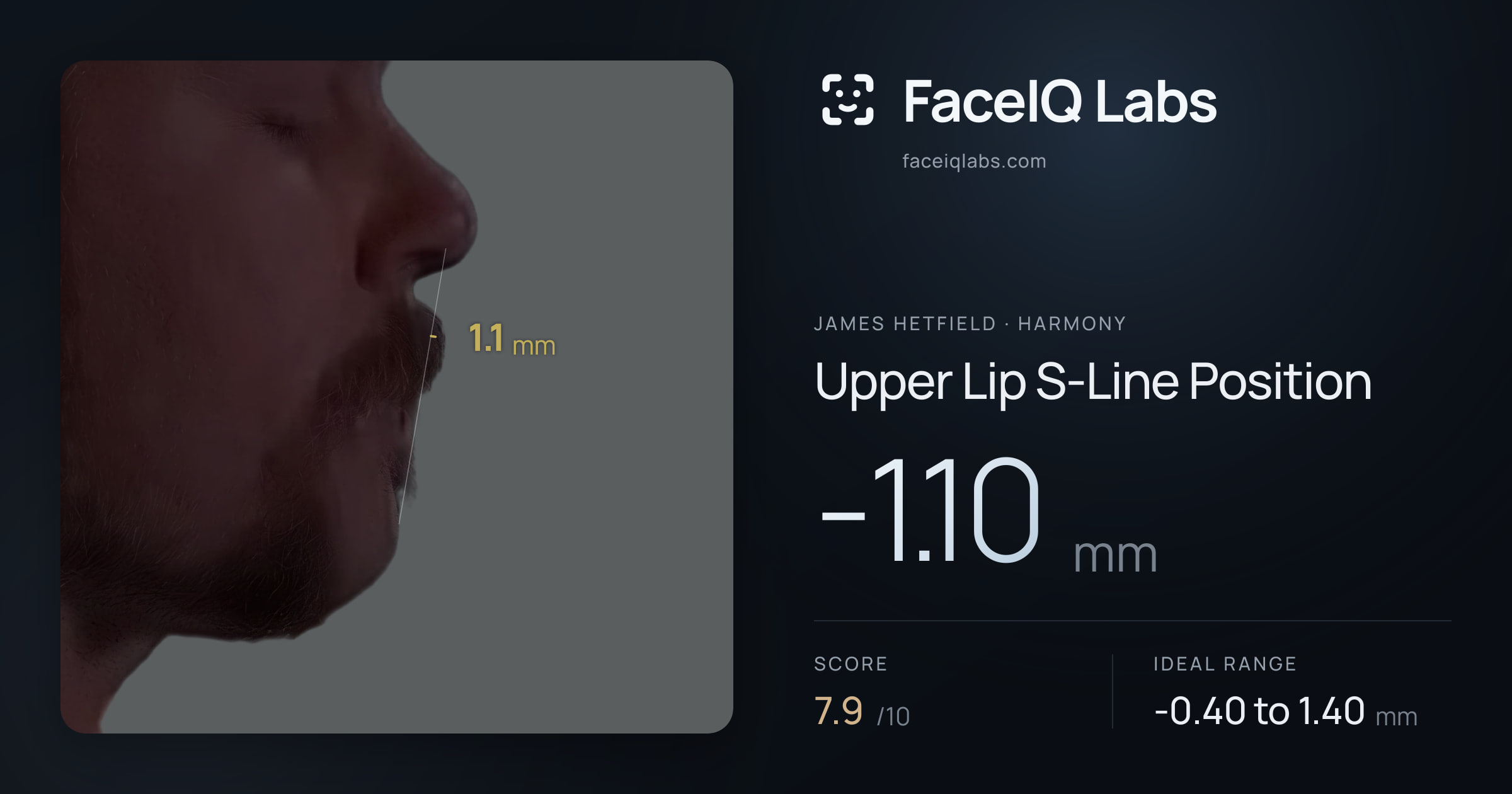 James Hetfield Upper Lip S-Line Position: -1.10mm, drawn on the photo