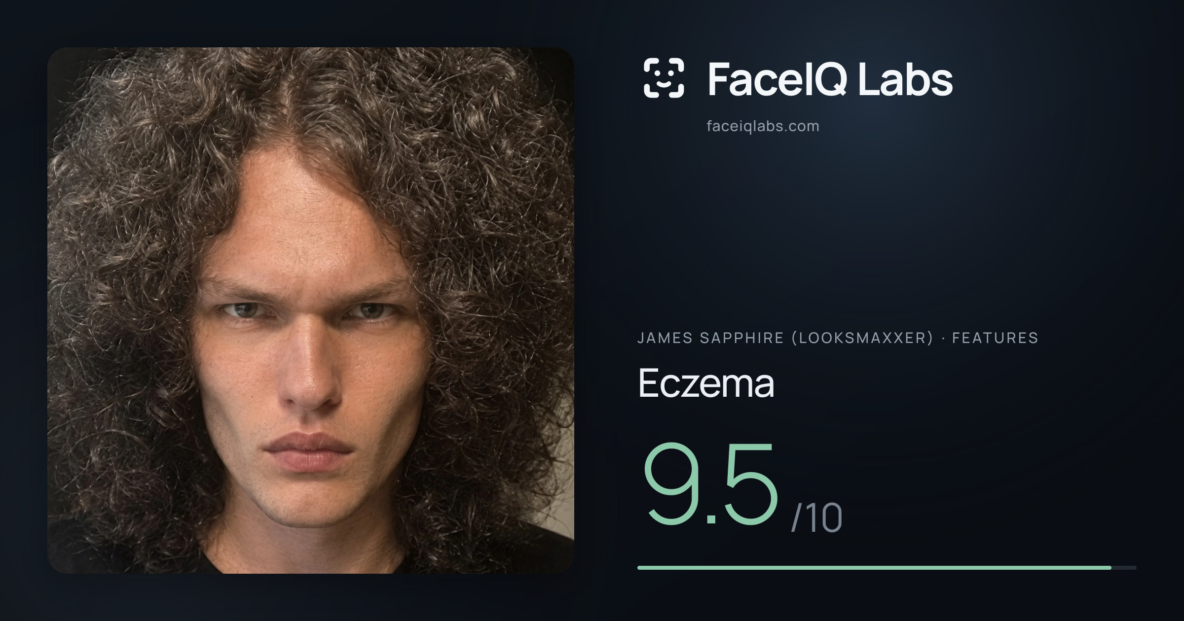 James Sapphire (Looksmaxxer) Eczema: 9.5/10, drawn on the photo
