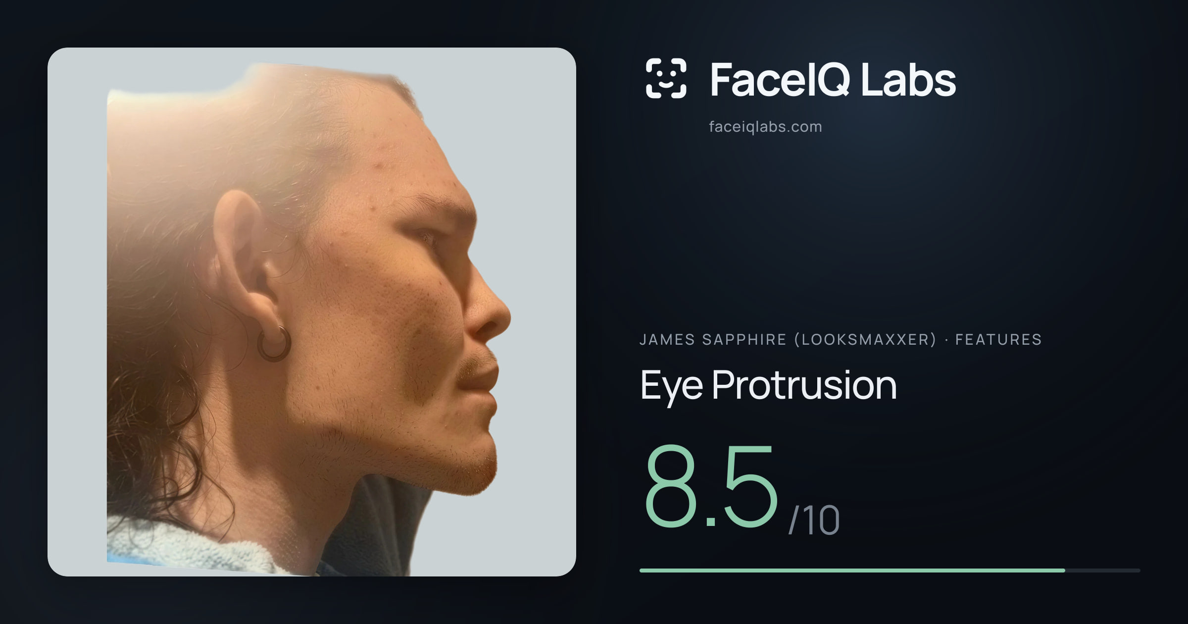 James Sapphire (Looksmaxxer) Eye Protrusion: 8.5/10, drawn on the photo