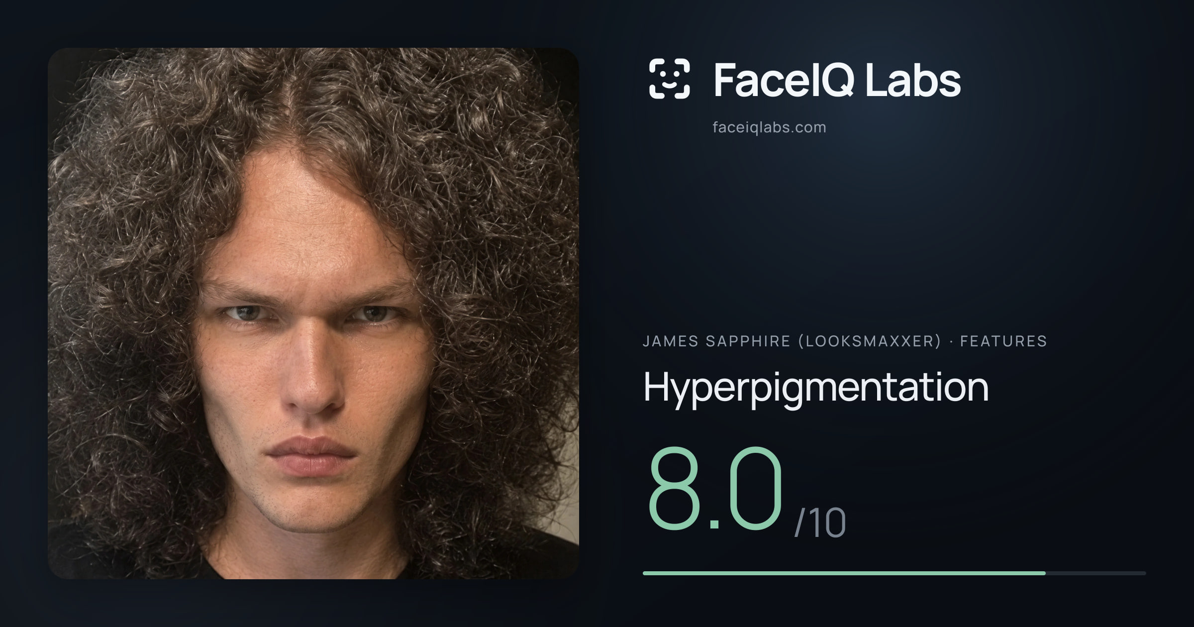 James Sapphire (Looksmaxxer) Hyperpigmentation: 8.0/10, drawn on the photo