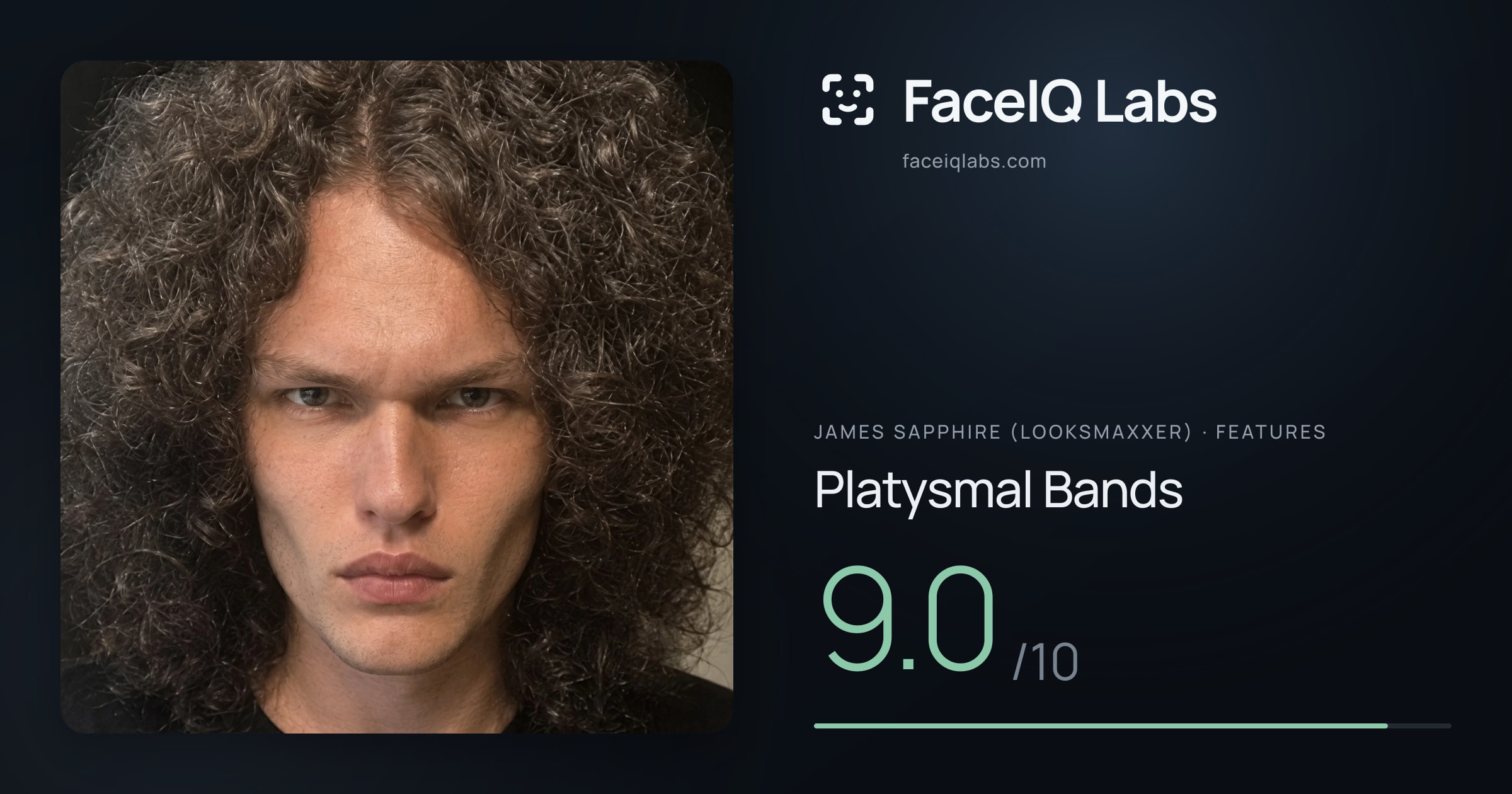 James Sapphire (Looksmaxxer) Platysmal Bands: 9.0/10, drawn on the photo