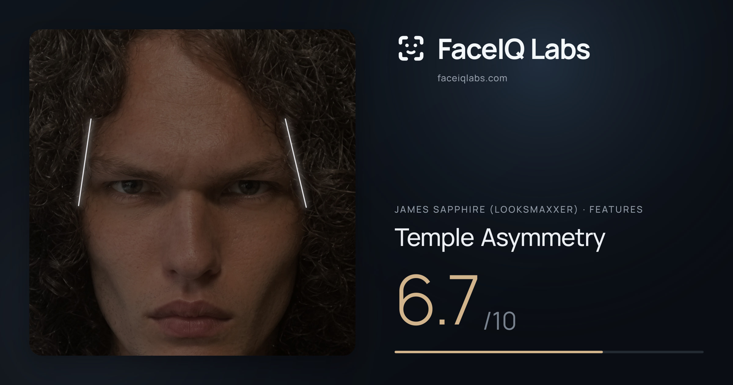 James Sapphire (Looksmaxxer) Temple Asymmetry: 6.7/10, drawn on the photo