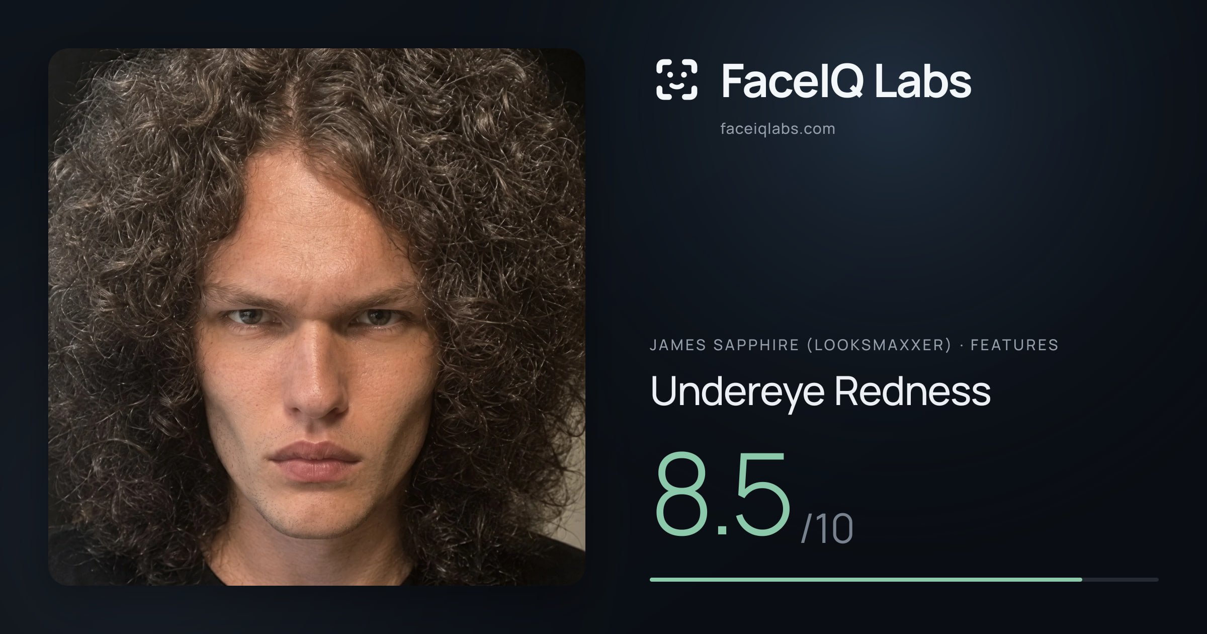 James Sapphire (Looksmaxxer) Undereye Redness: 8.5/10, drawn on the photo