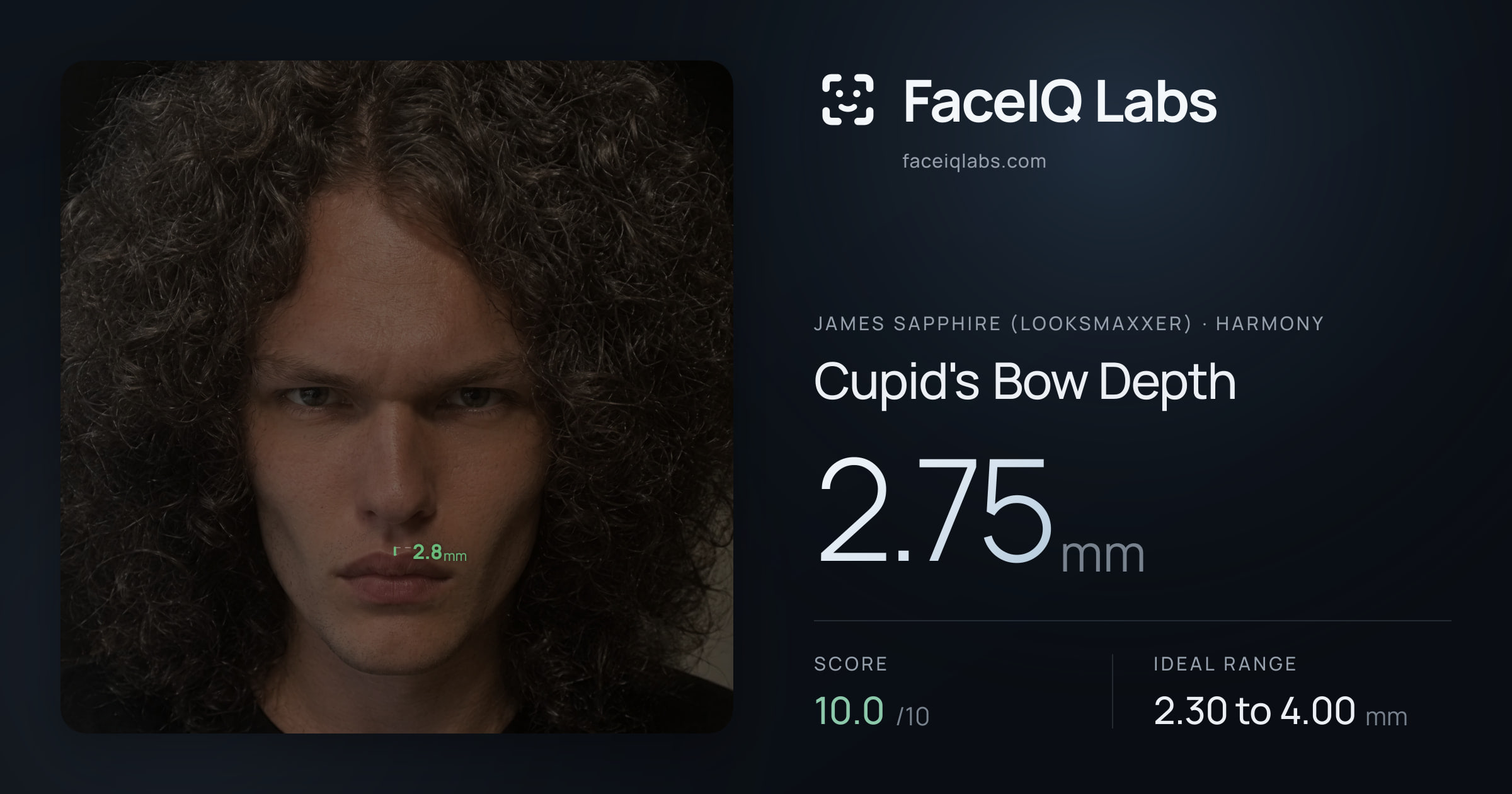 James Sapphire (Looksmaxxer) Cupid's Bow Depth: 2.75mm, drawn on the photo