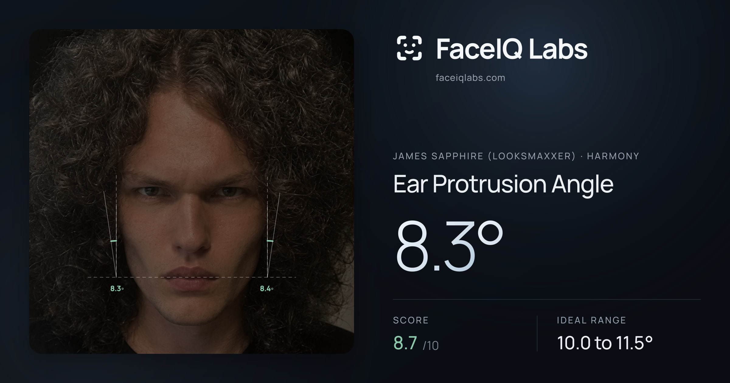 James Sapphire (Looksmaxxer) Ear Protrusion Angle: 8.3°, drawn on the photo