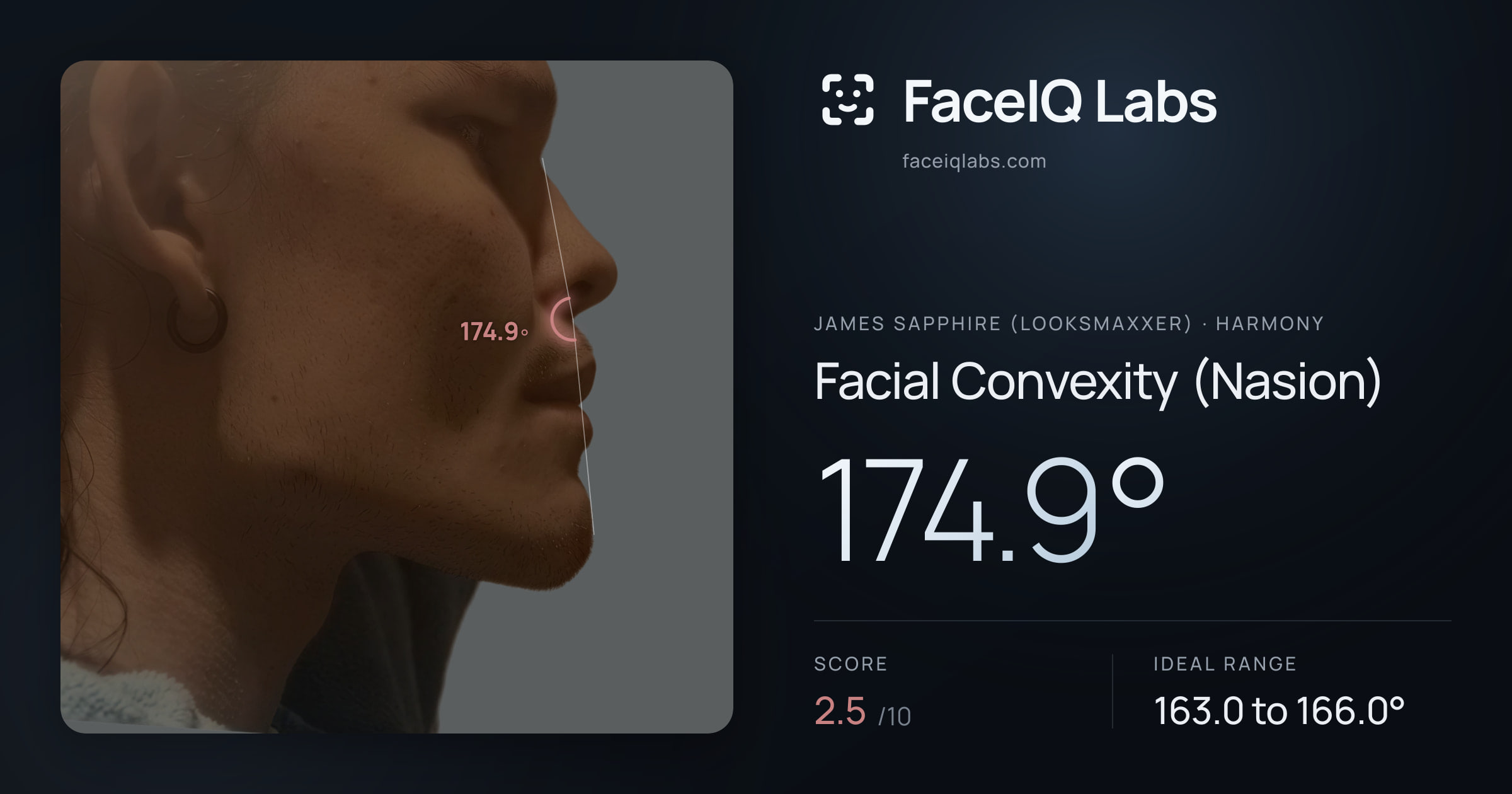 James Sapphire (Looksmaxxer) Facial Convexity (Nasion): 174.9°, drawn on the photo