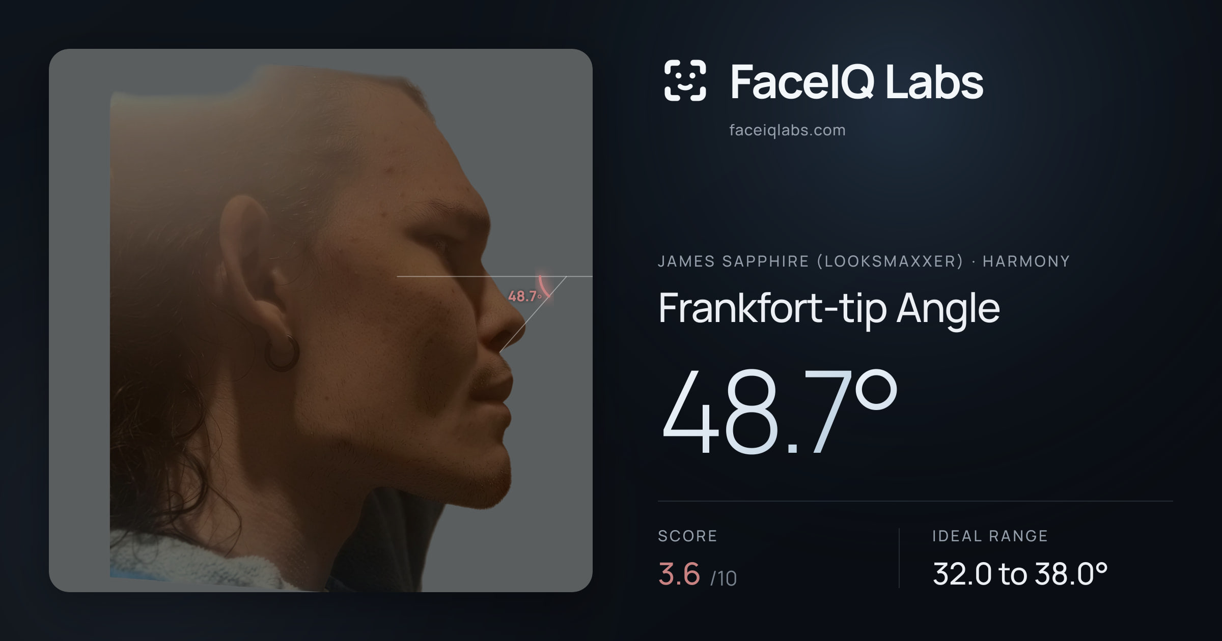 James Sapphire (Looksmaxxer) Frankfort-tip Angle: 48.7°, drawn on the photo