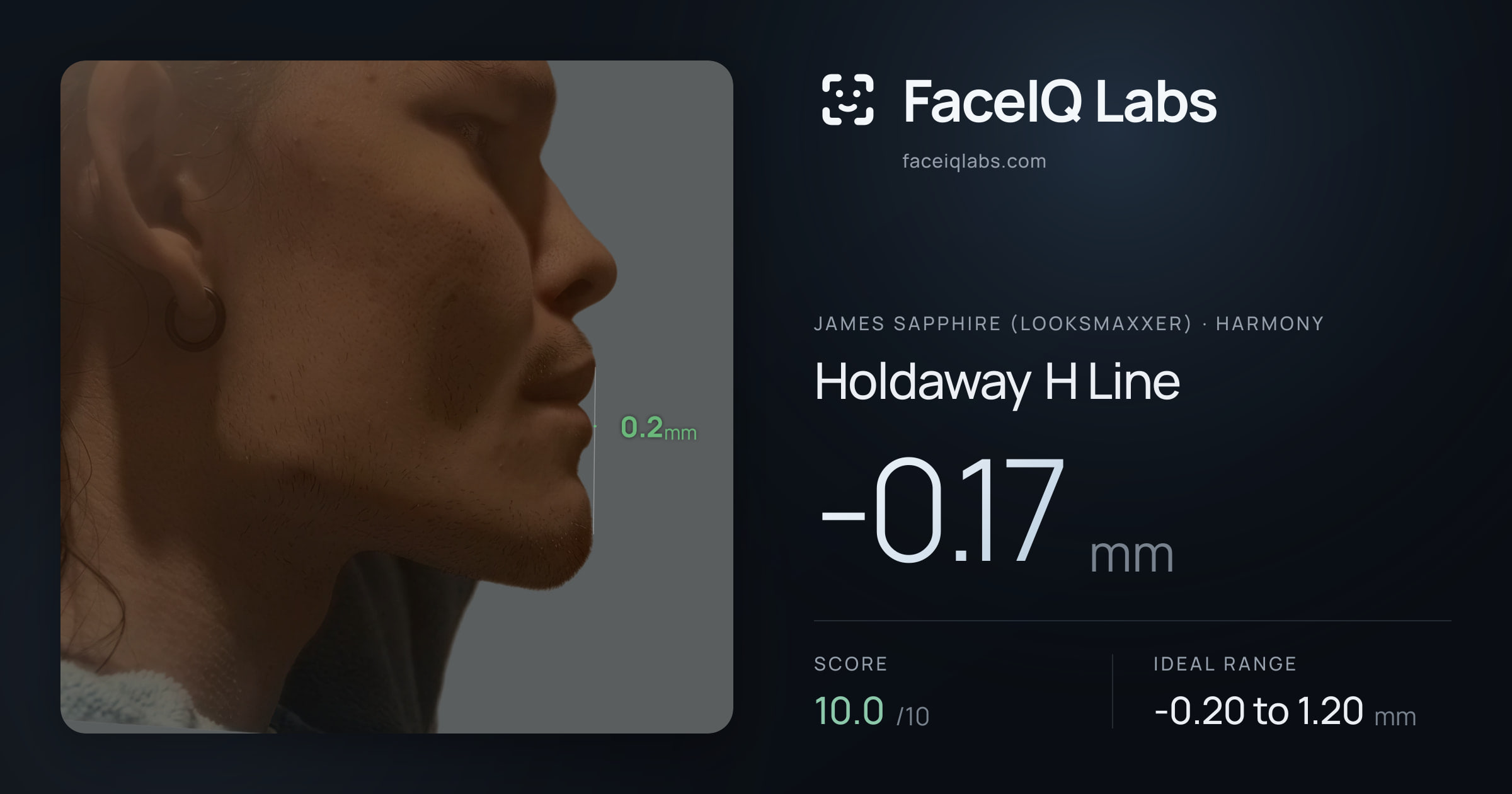 James Sapphire (Looksmaxxer) Holdaway H Line: -0.17mm, drawn on the photo