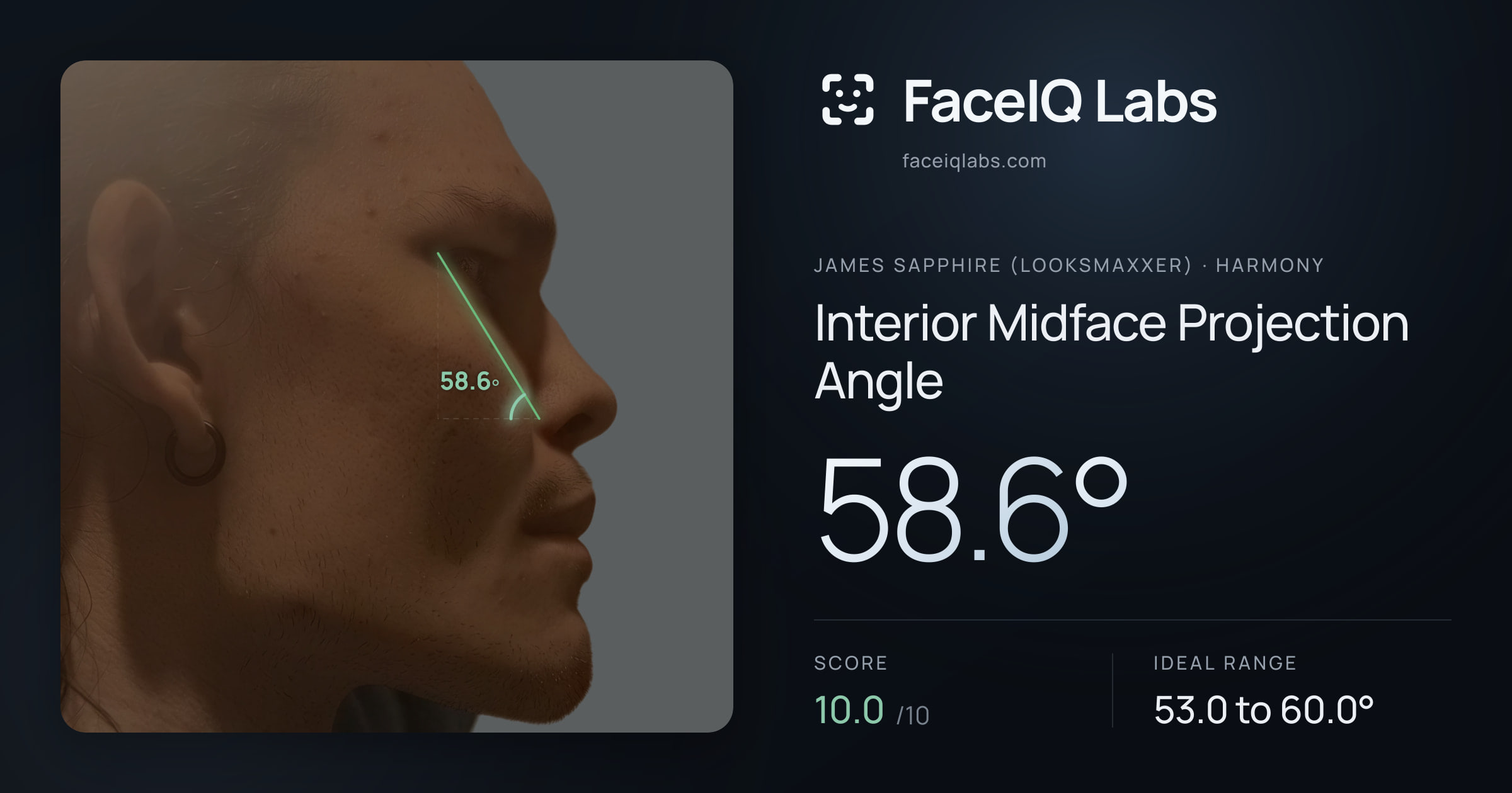 James Sapphire (Looksmaxxer) Interior Midface Projection Angle: 58.6°, drawn on the photo