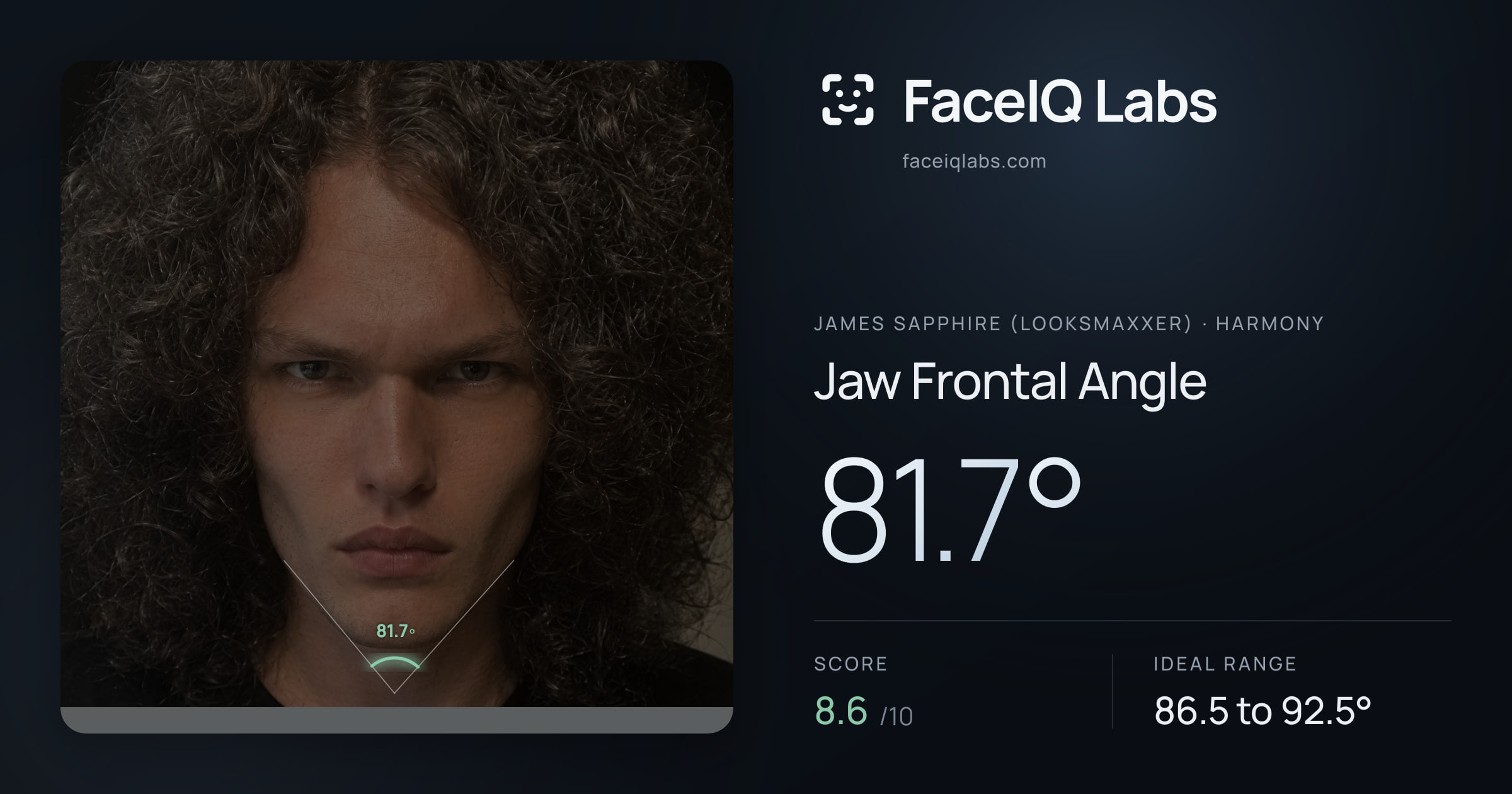 James Sapphire (Looksmaxxer) Jaw Frontal Angle: 81.7°, drawn on the photo