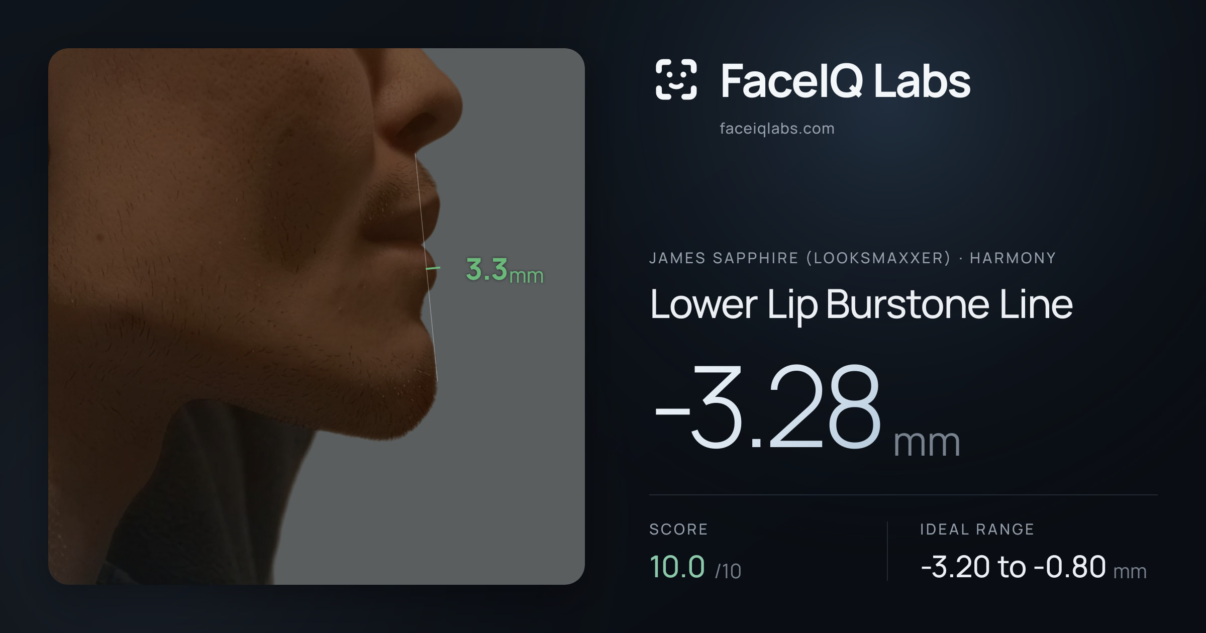 James Sapphire (Looksmaxxer) Lower Lip Burstone Line: -3.28mm, drawn on the photo