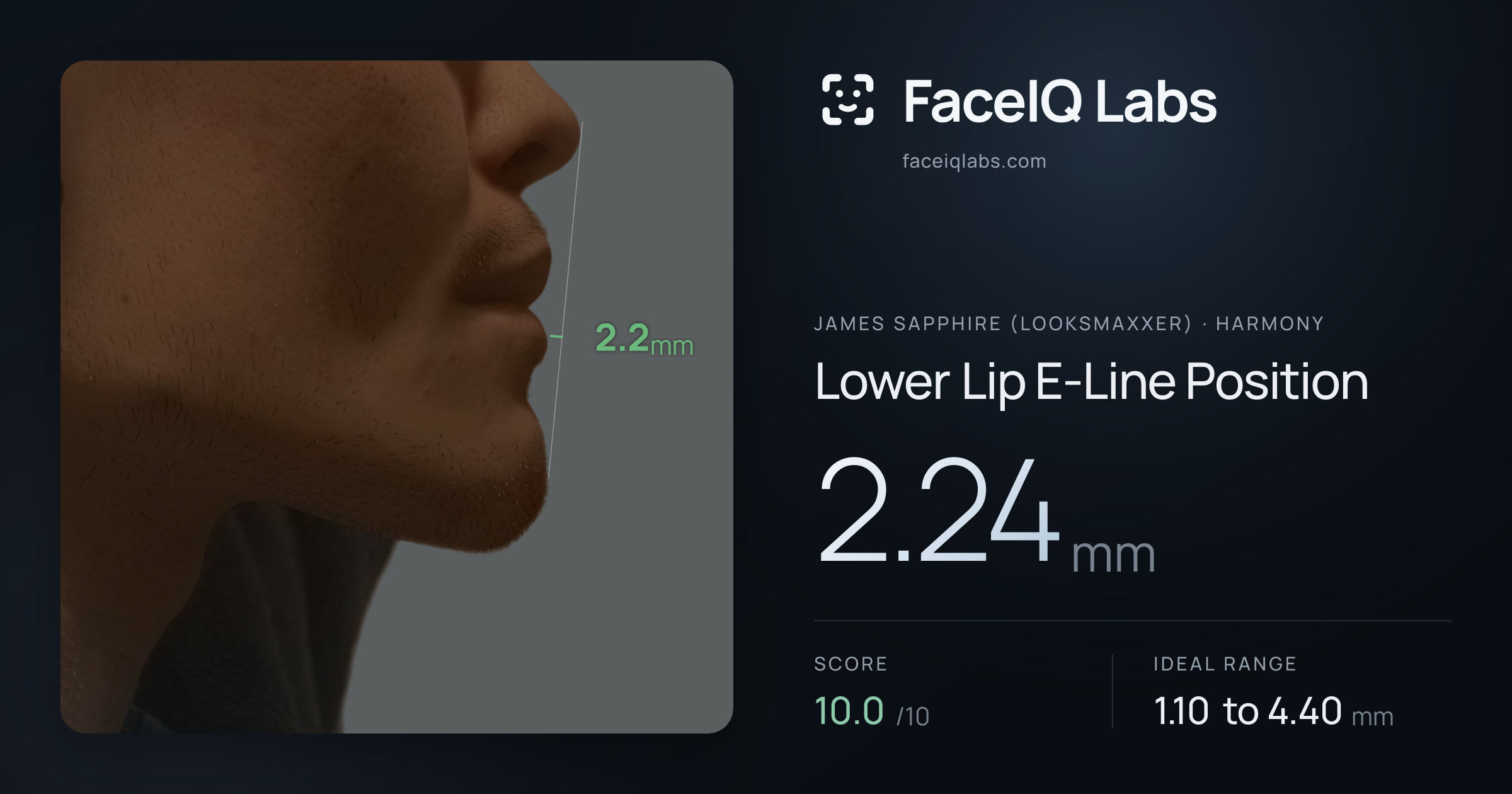 James Sapphire (Looksmaxxer) Lower Lip E-Line Position: 2.24mm, drawn on the photo