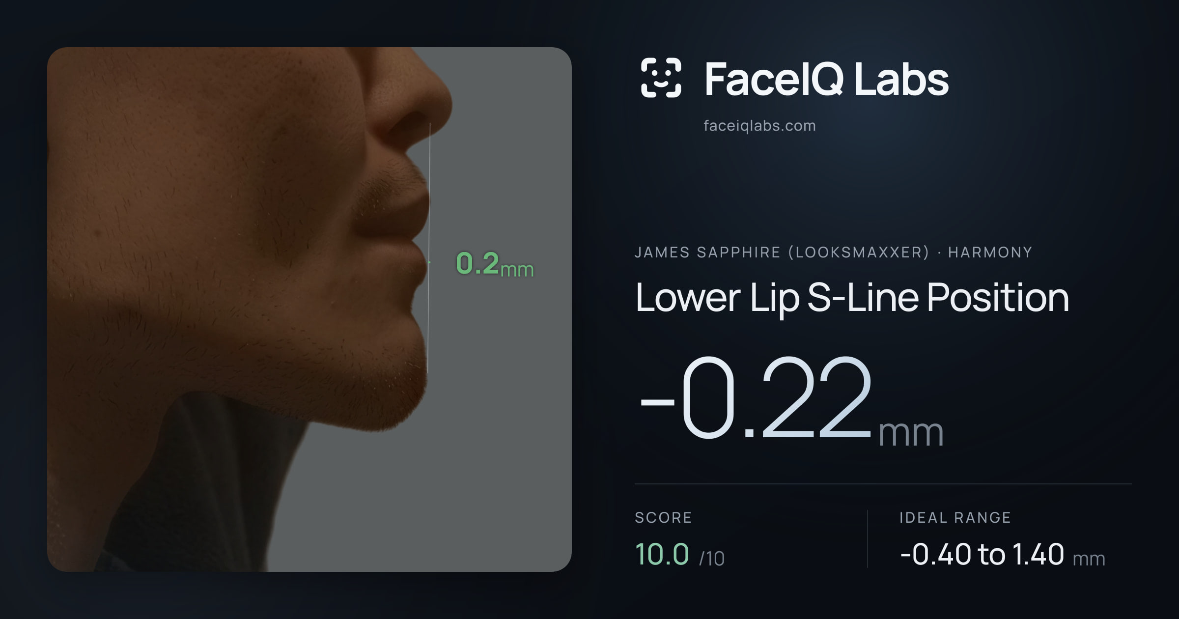 James Sapphire (Looksmaxxer) Lower Lip S-Line Position: -0.22mm, drawn on the photo