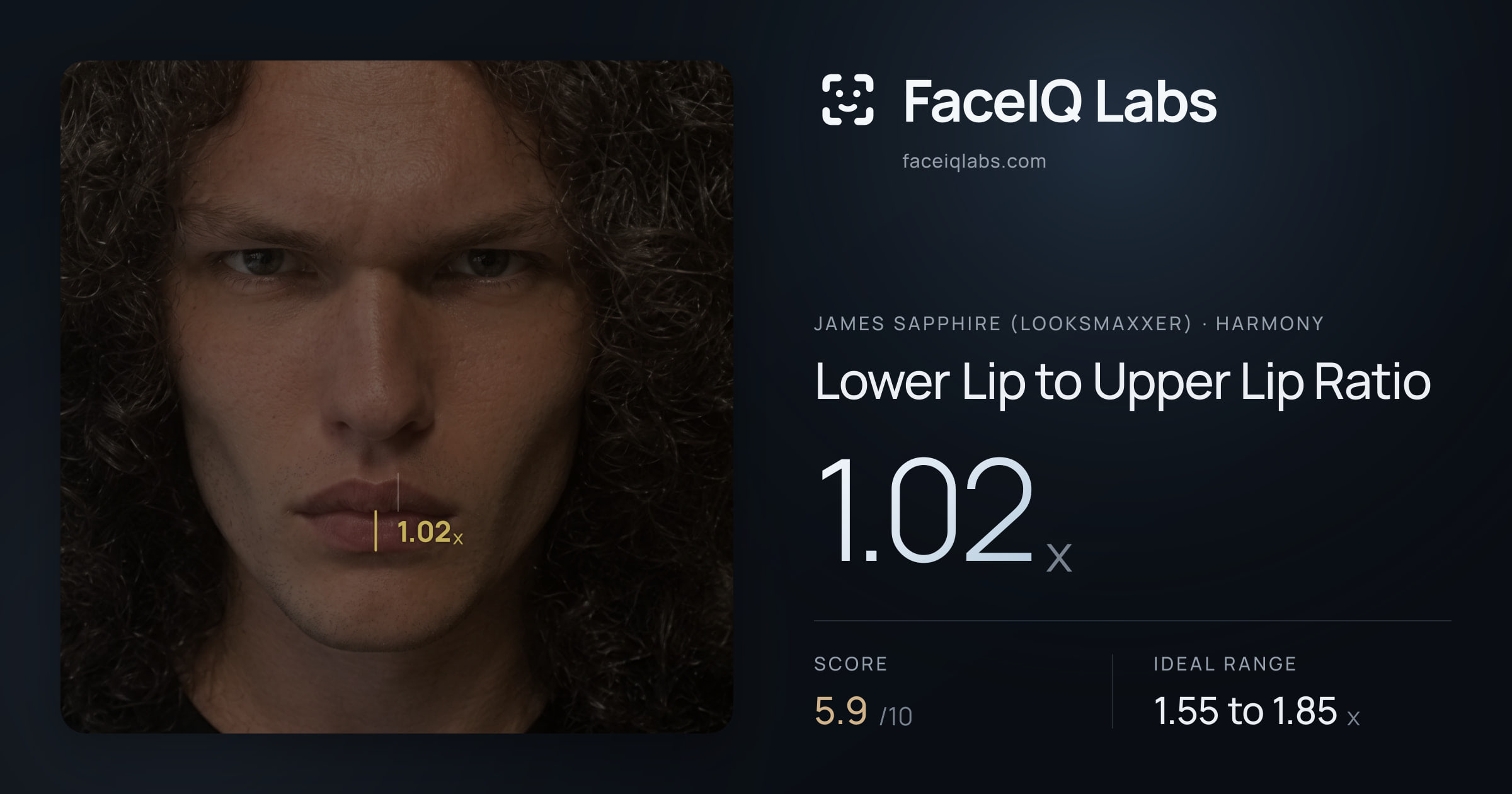 James Sapphire (Looksmaxxer) Lower Lip to Upper Lip Ratio: 1.02x, drawn on the photo