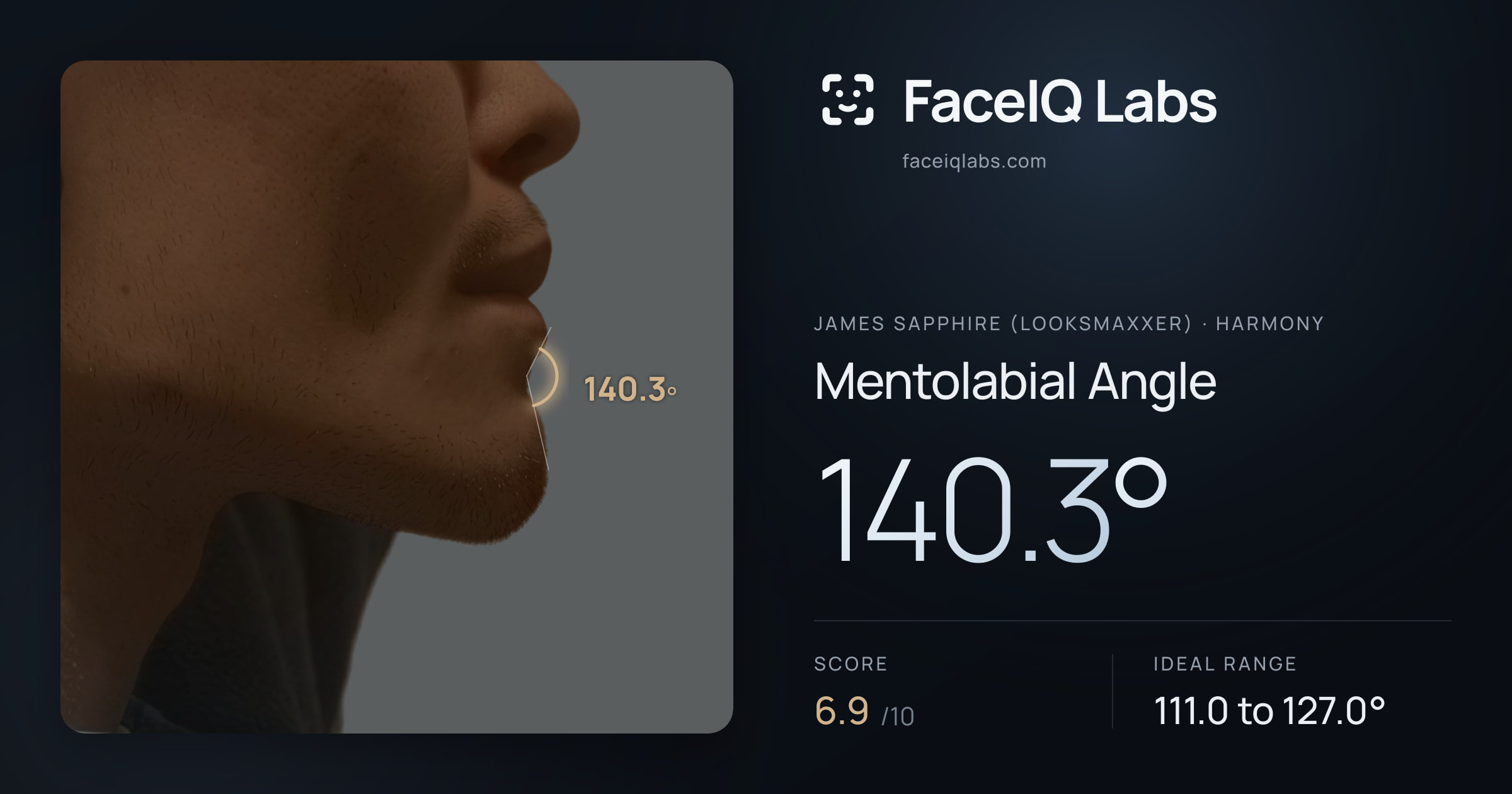 James Sapphire (Looksmaxxer) Mentolabial Angle: 140.3°, drawn on the photo