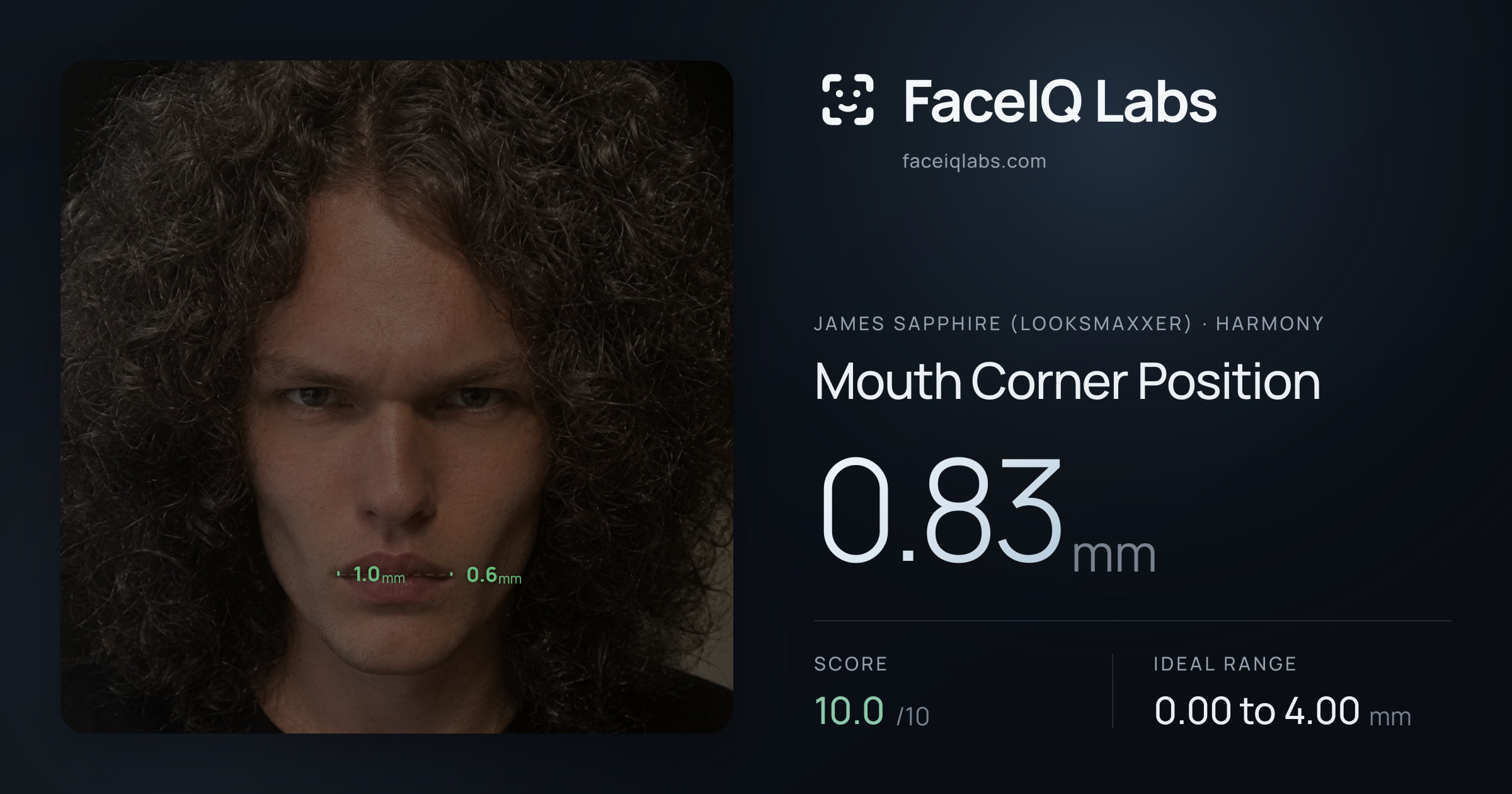 James Sapphire (Looksmaxxer) Mouth Corner Position: 0.83mm, drawn on the photo