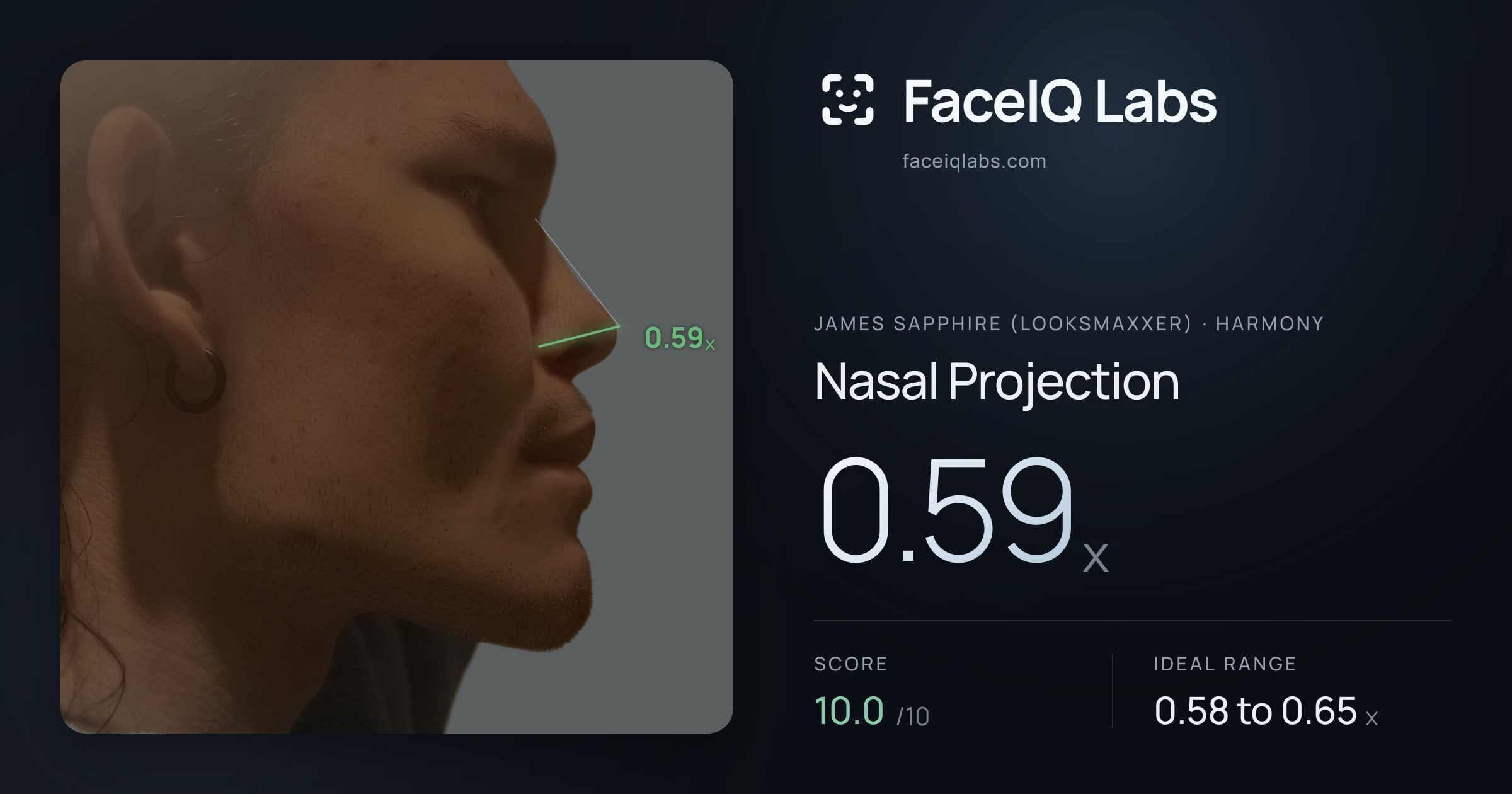 James Sapphire (Looksmaxxer) Nasal Projection: 0.59x, drawn on the photo