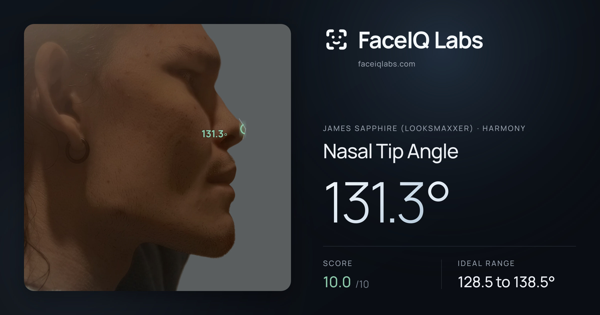 James Sapphire (Looksmaxxer) Nasal Tip Angle: 131.3°, drawn on the photo