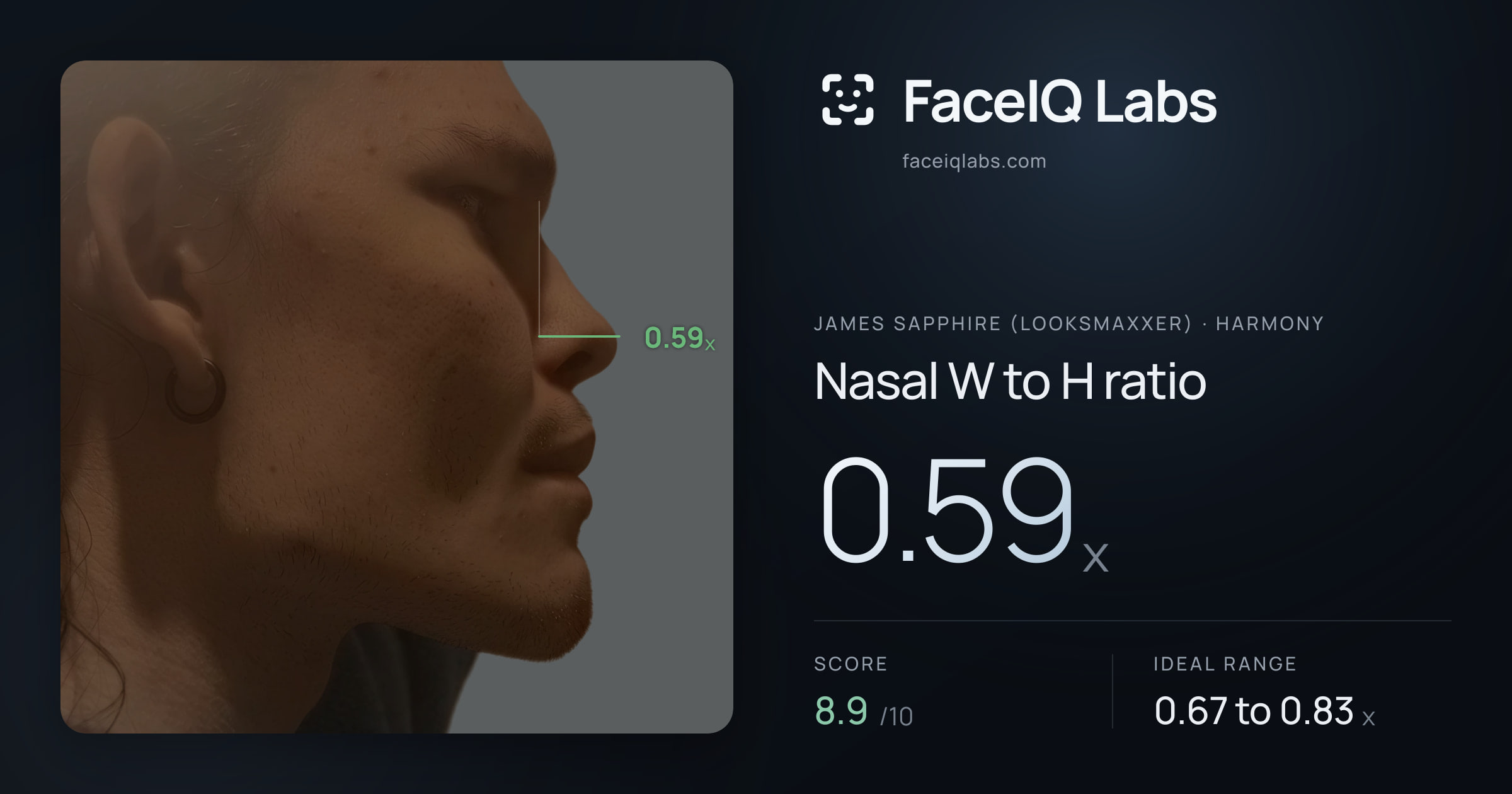 James Sapphire (Looksmaxxer) Nasal W to H ratio: 0.59x, drawn on the photo