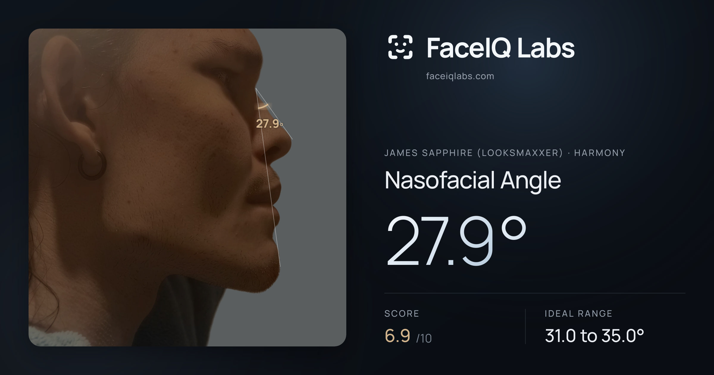 James Sapphire (Looksmaxxer) Nasofacial Angle: 27.9°, drawn on the photo