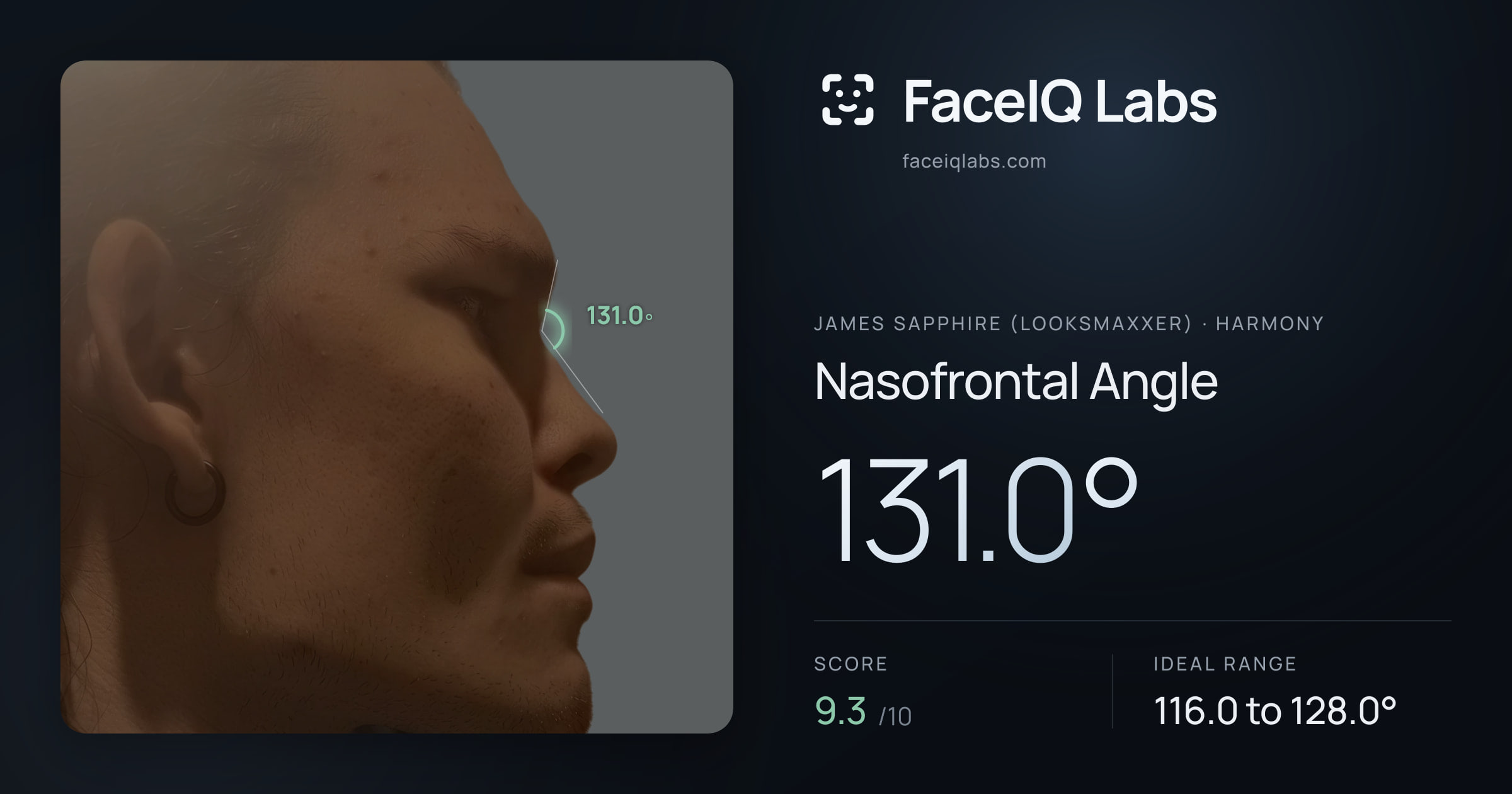 James Sapphire (Looksmaxxer) Nasofrontal Angle: 131.0°, drawn on the photo