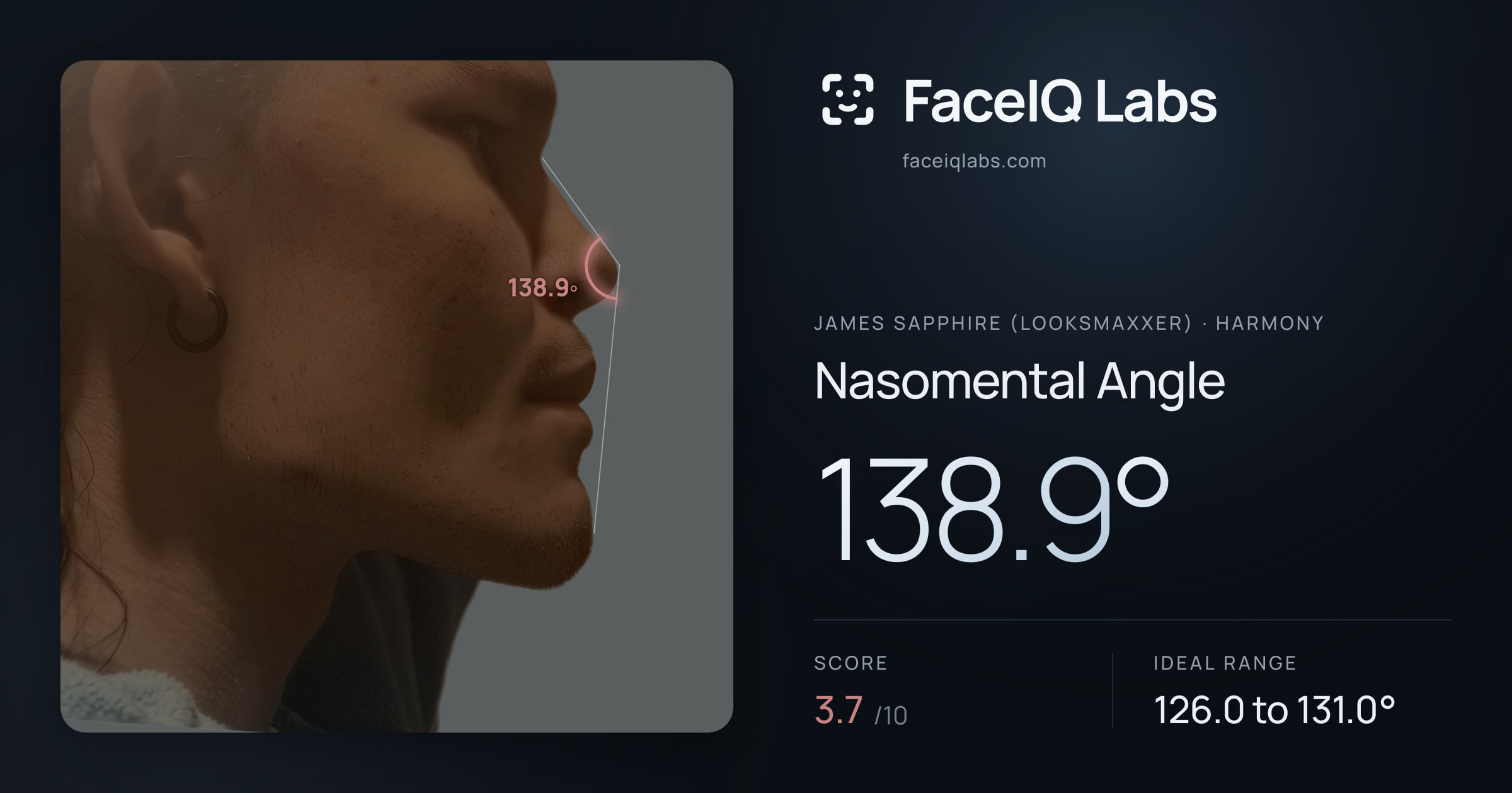 James Sapphire (Looksmaxxer) Nasomental Angle: 138.9°, drawn on the photo