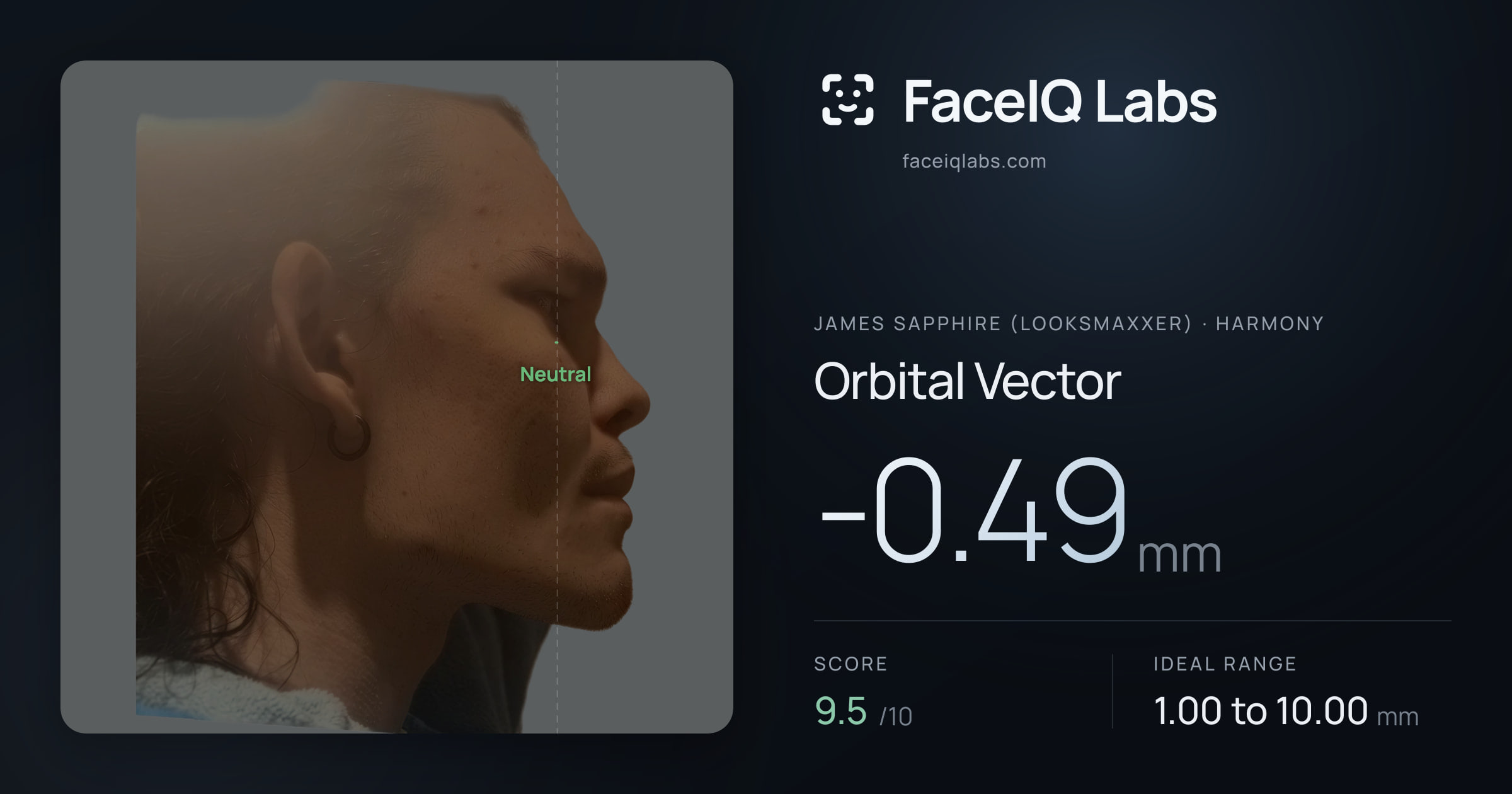 James Sapphire (Looksmaxxer) Orbital Vector: -0.49mm, drawn on the photo