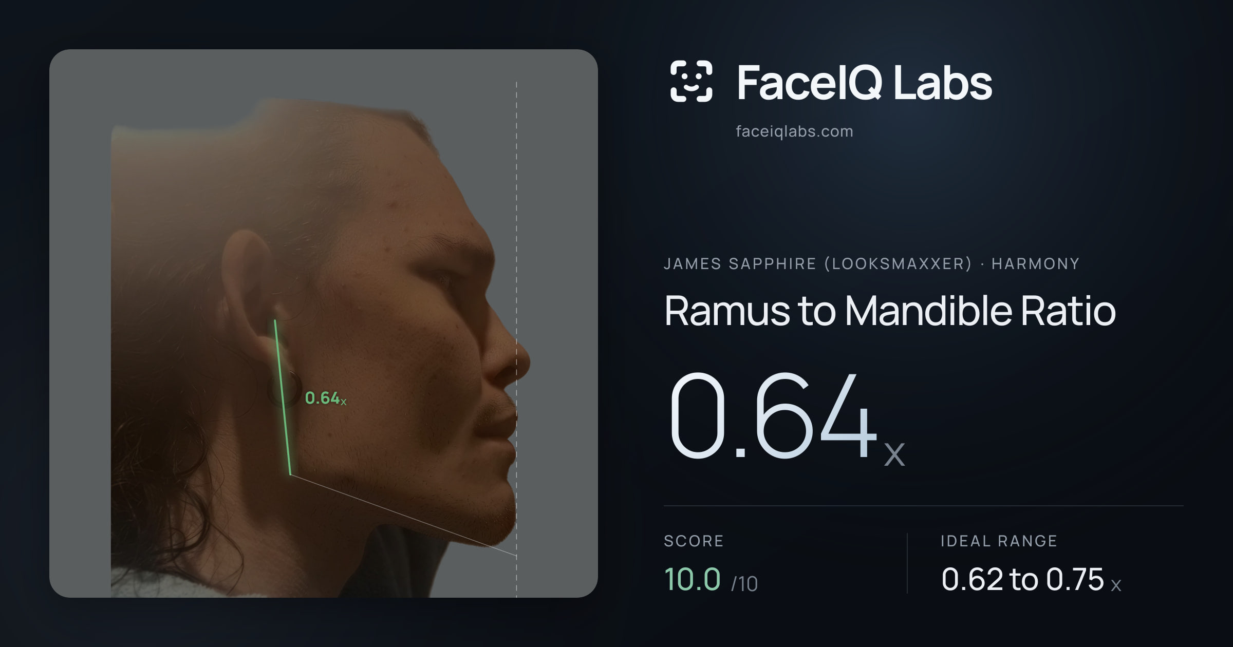James Sapphire (Looksmaxxer) Ramus to Mandible Ratio: 0.64x, drawn on the photo