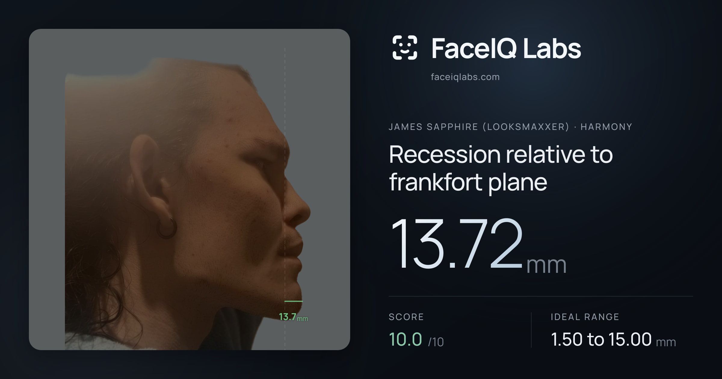 James Sapphire (Looksmaxxer) Recession relative to frankfort plane: 13.72mm, drawn on the photo
