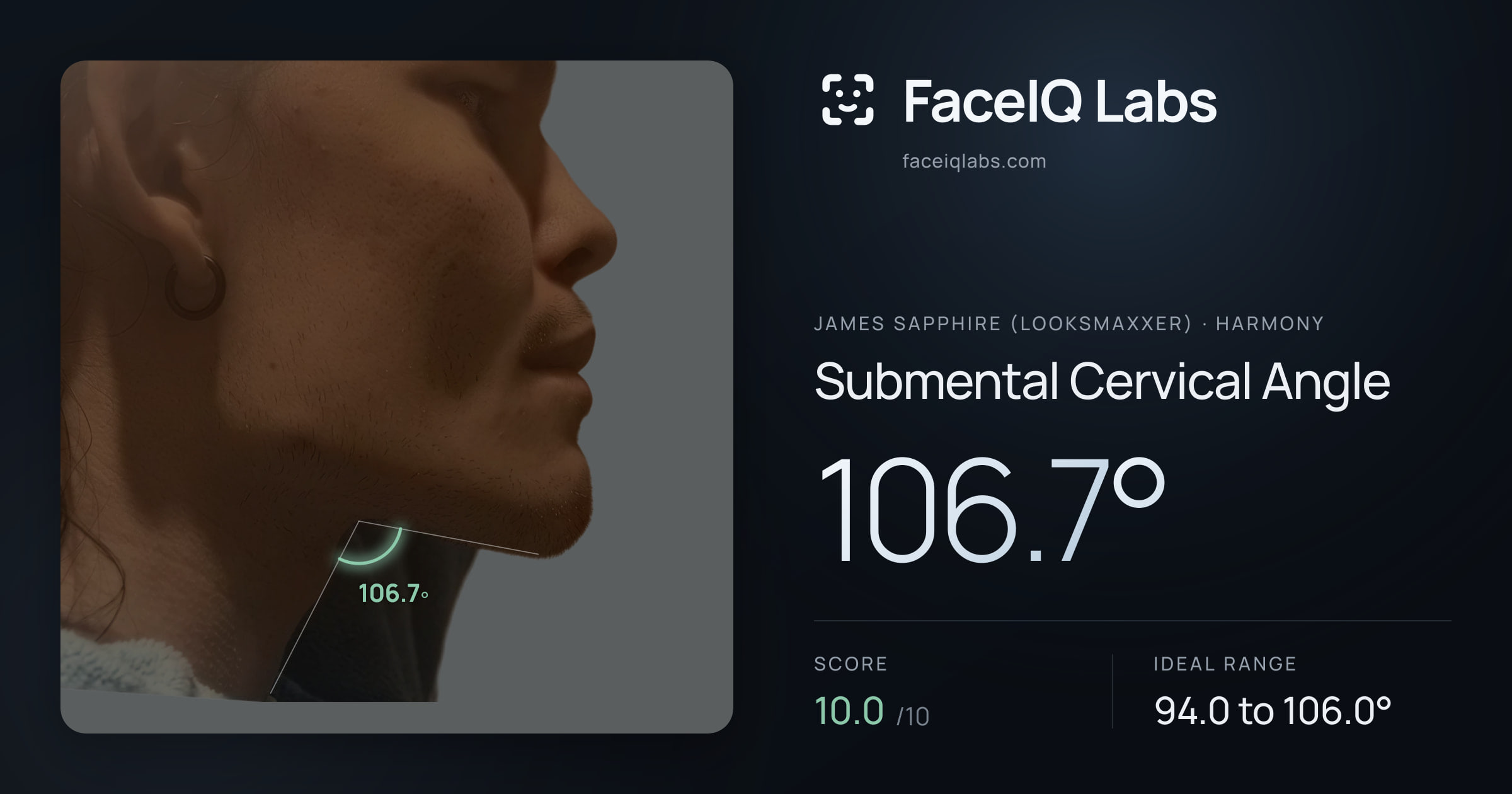 James Sapphire (Looksmaxxer) Submental Cervical Angle: 106.7°, drawn on the photo