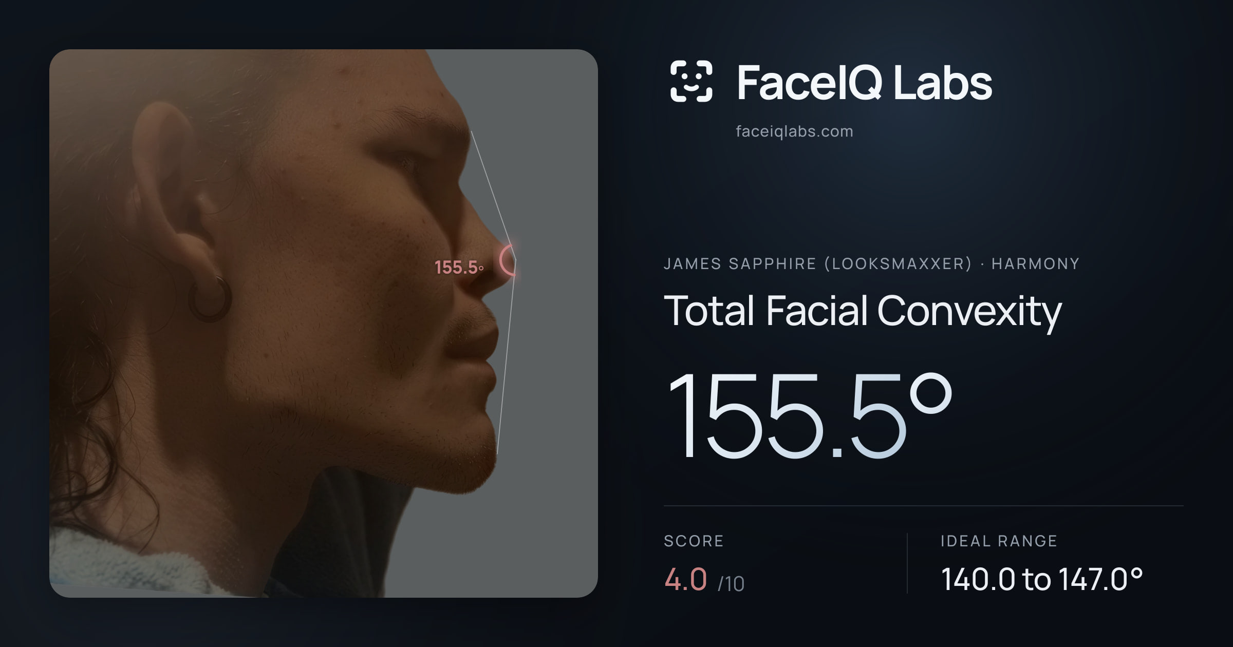 James Sapphire (Looksmaxxer) Total Facial Convexity: 155.5°, drawn on the photo