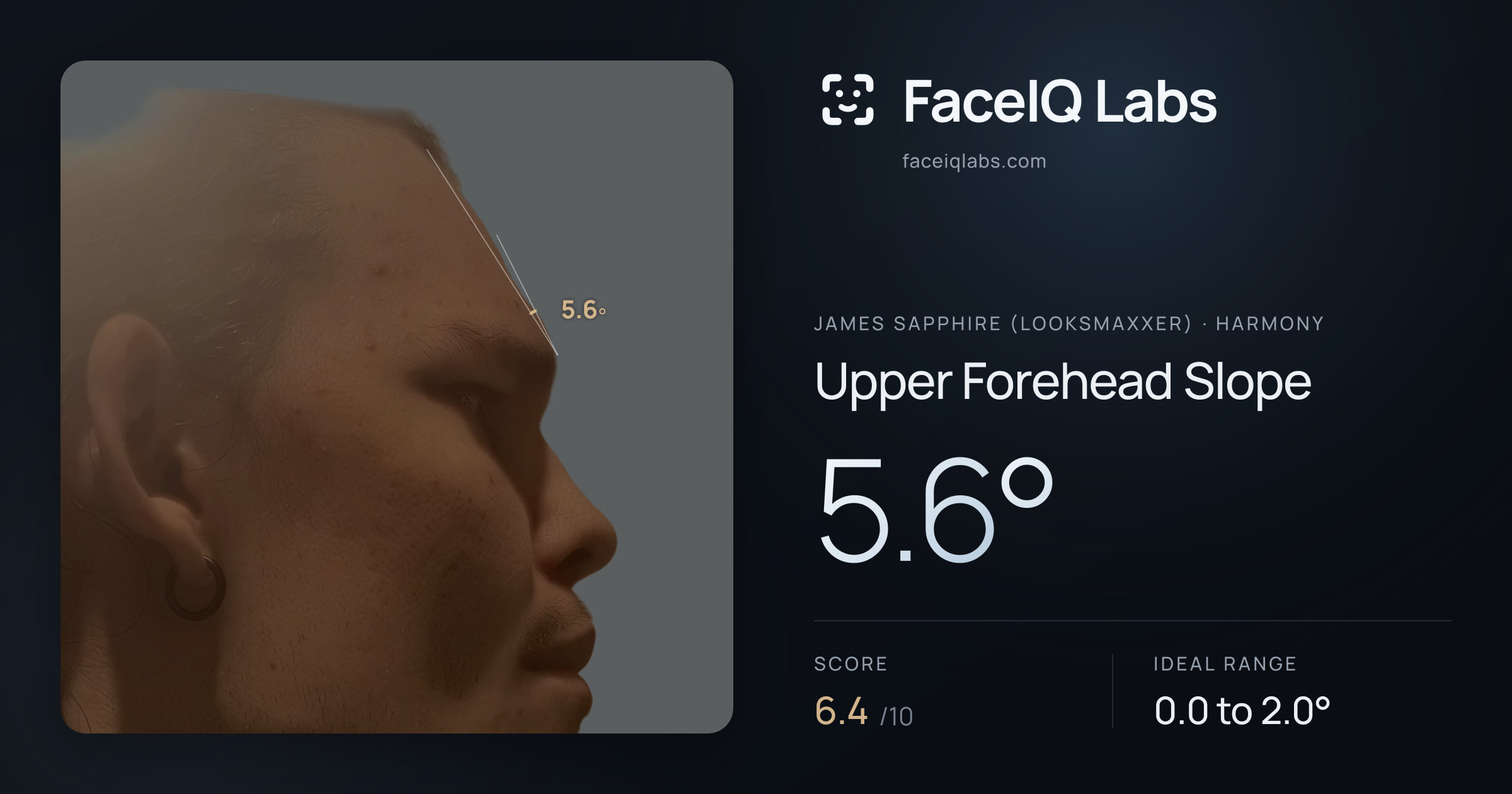 James Sapphire (Looksmaxxer) Upper Forehead Slope: 5.6°, drawn on the photo