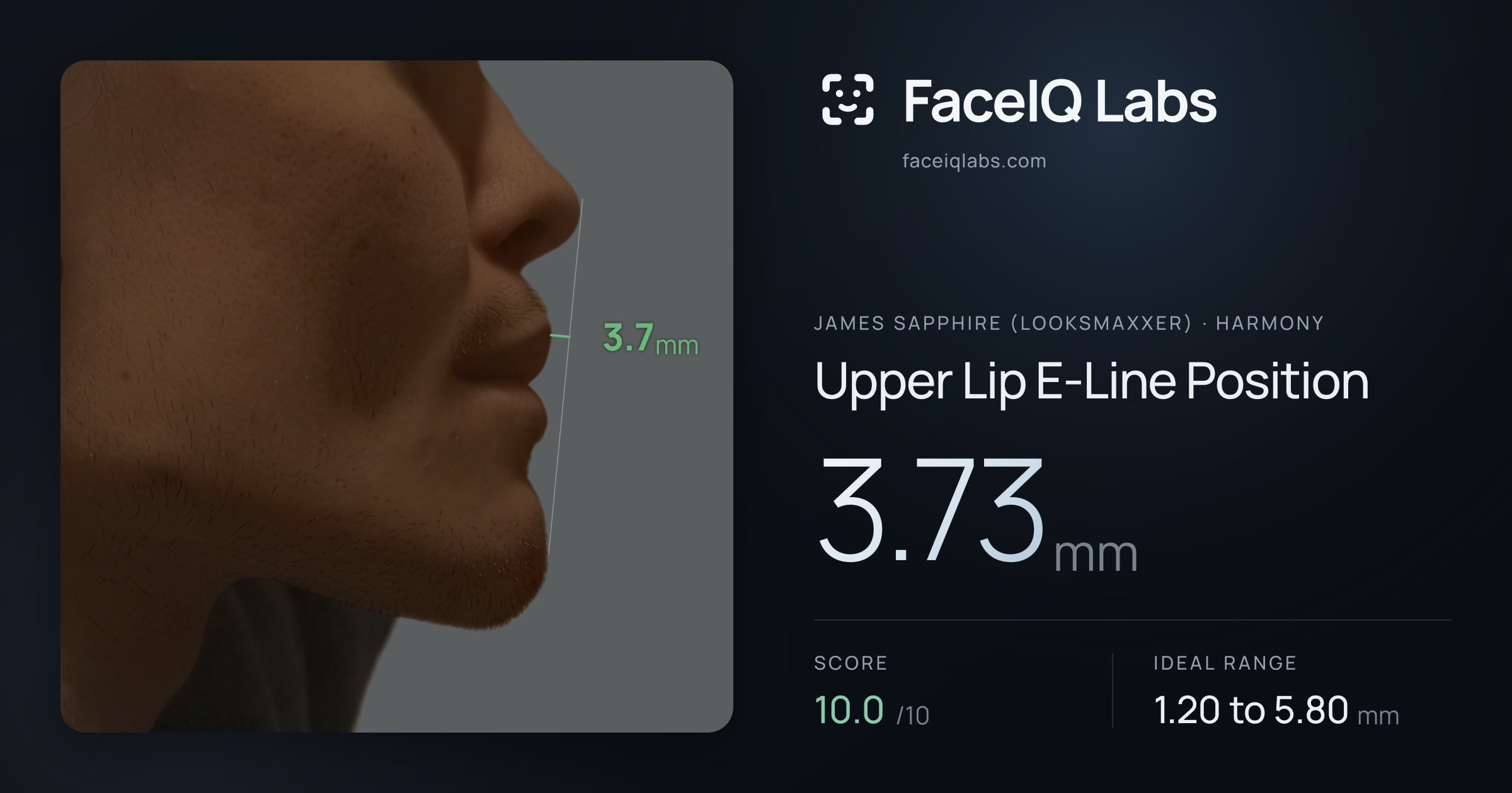 James Sapphire (Looksmaxxer) Upper Lip E-Line Position: 3.73mm, drawn on the photo