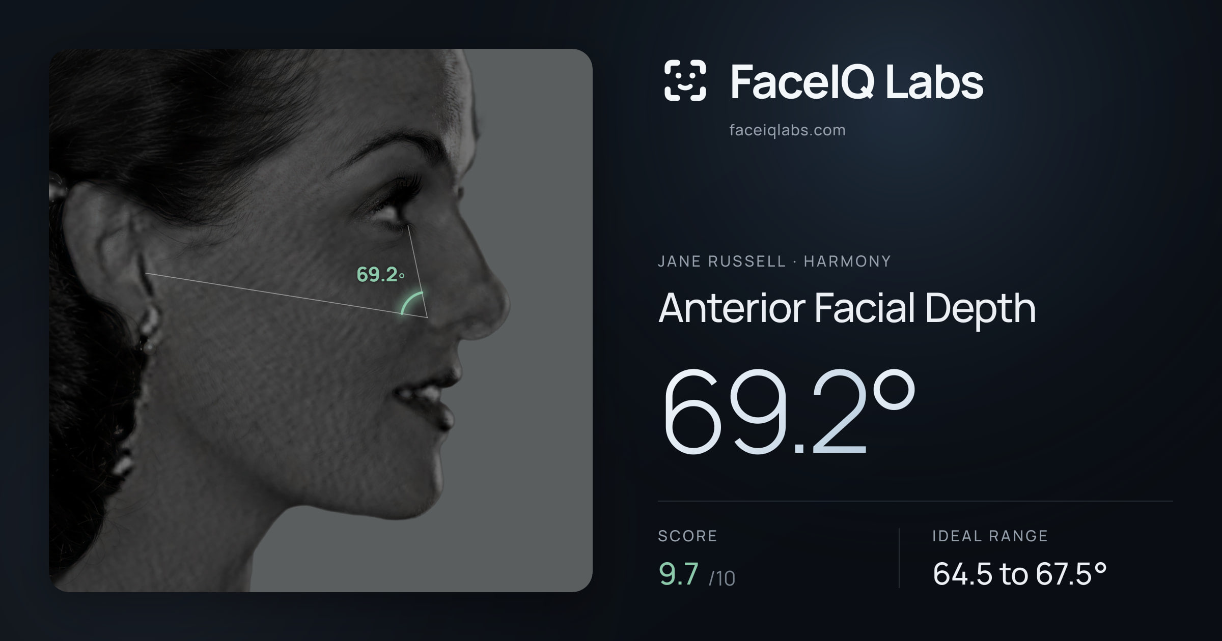 Jane Russell Anterior Facial Depth: 69.2°, drawn on the photo