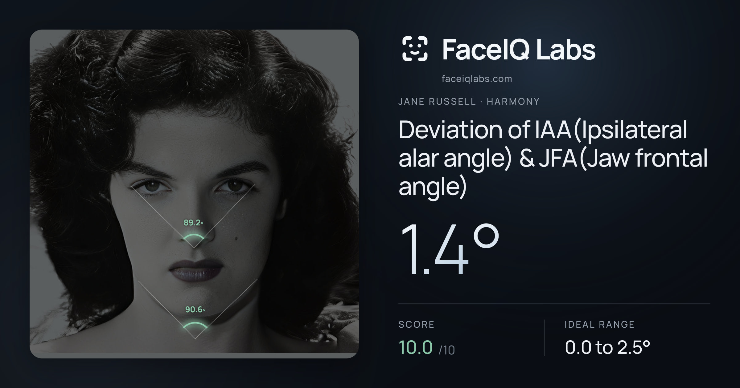 Jane Russell Deviation of IAA(Ipsilateral alar angle) & JFA(Jaw frontal angle): 1.4°, drawn on the photo