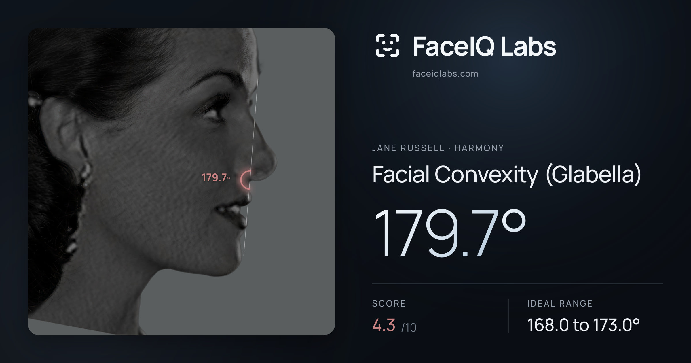 Jane Russell Facial Convexity (Glabella): 179.7°, drawn on the photo