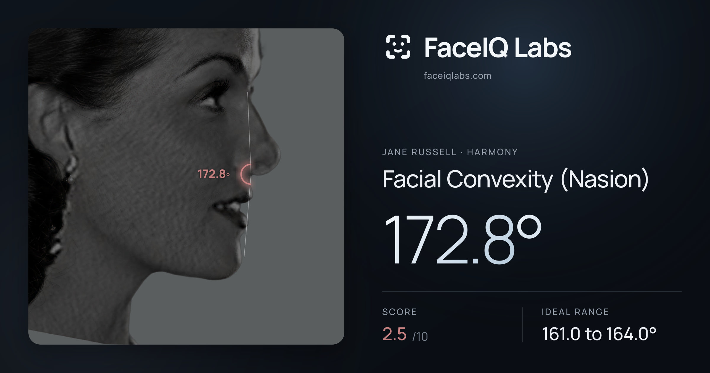 Jane Russell Facial Convexity (Nasion): 172.8°, drawn on the photo