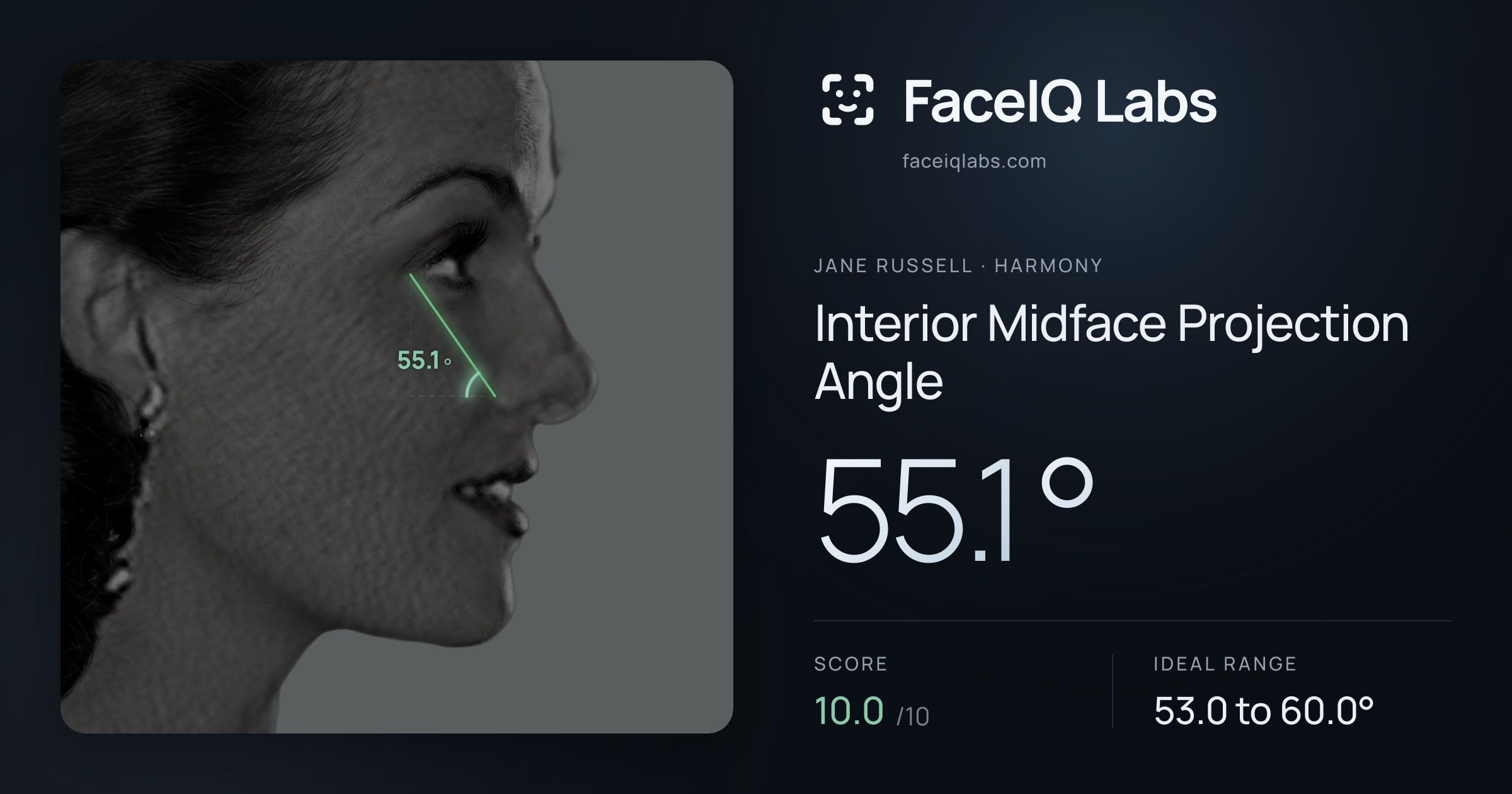 Jane Russell Interior Midface Projection Angle: 55.1°, drawn on the photo