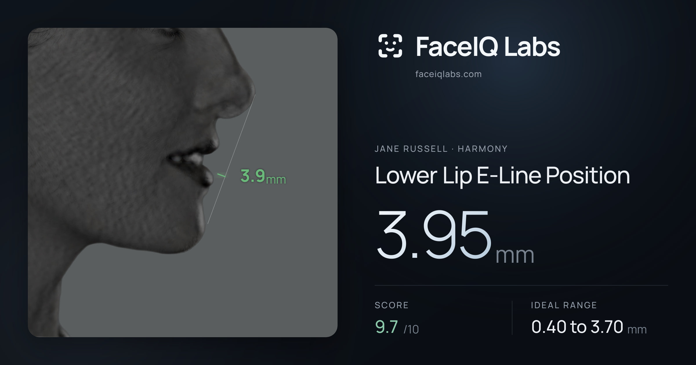 Jane Russell Lower Lip E-Line Position: 3.95mm, drawn on the photo
