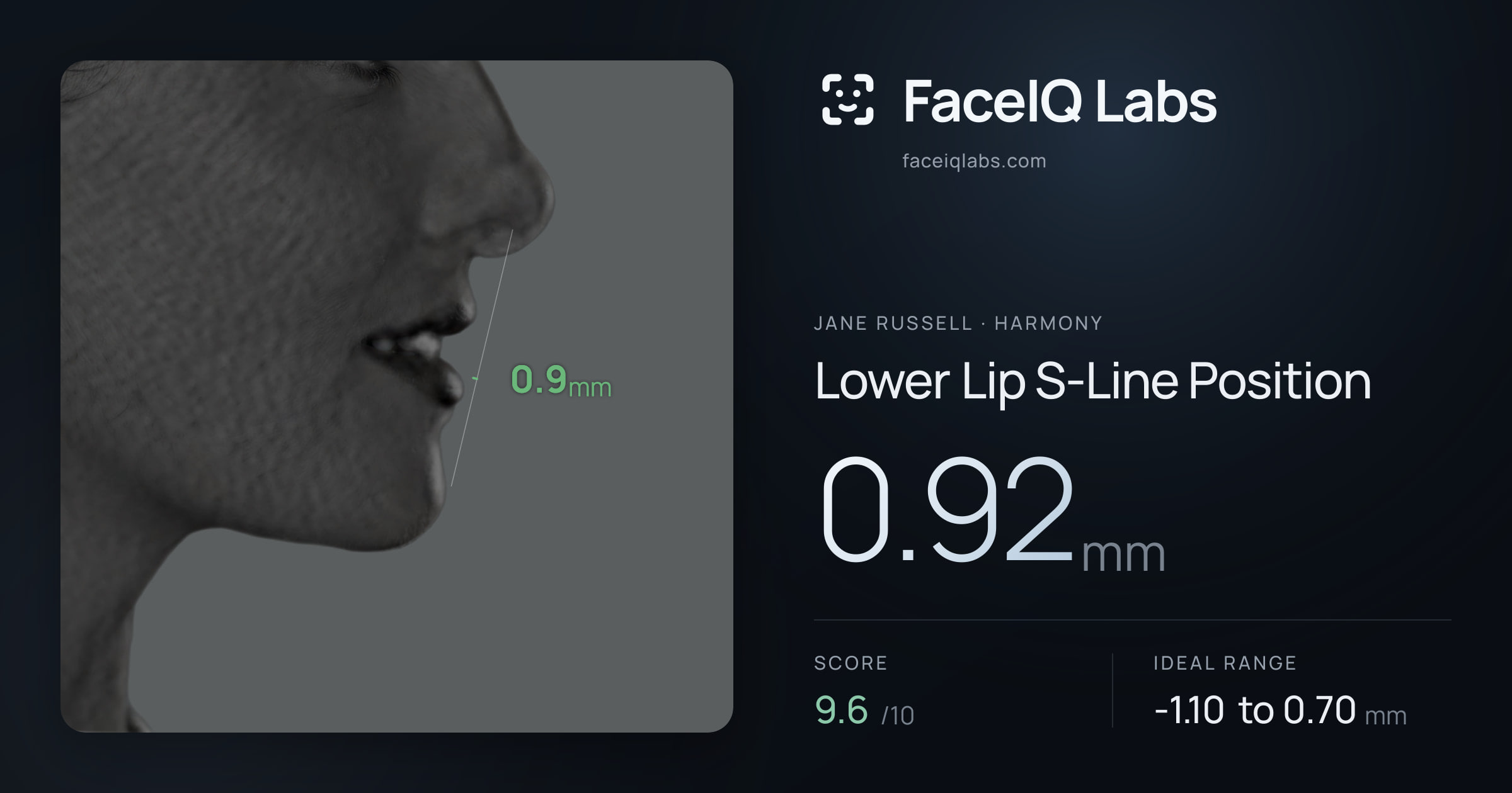 Jane Russell Lower Lip S-Line Position: 0.92mm, drawn on the photo