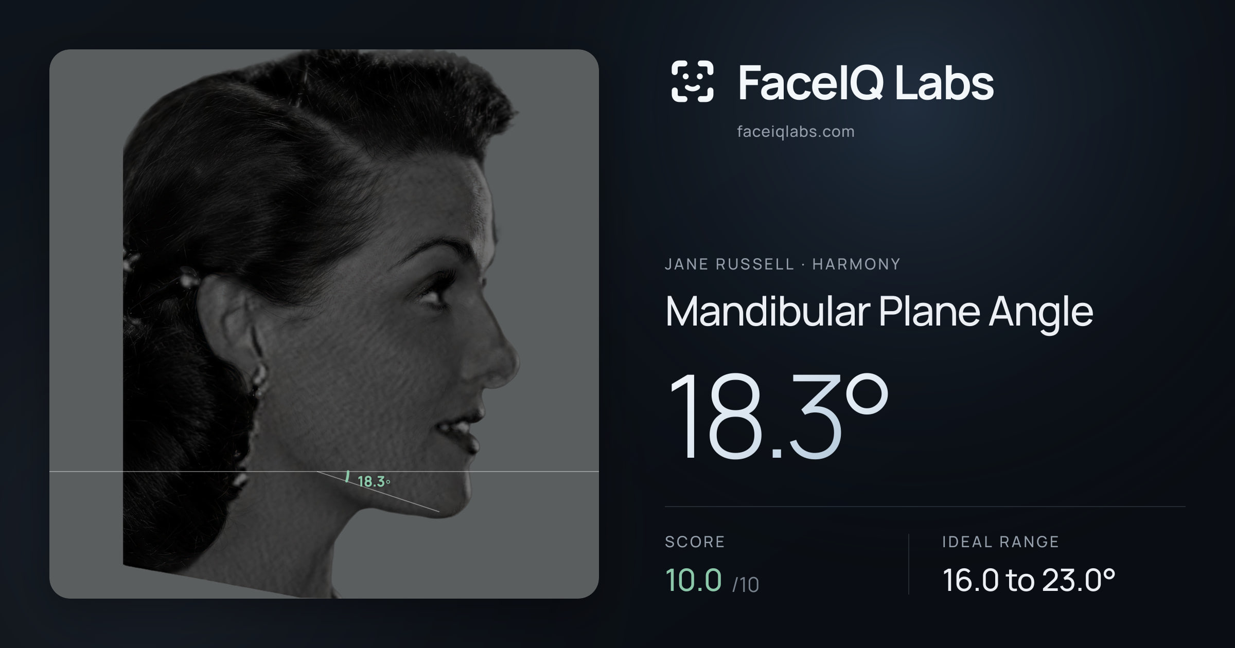 Jane Russell Mandibular Plane Angle: 18.3°, drawn on the photo