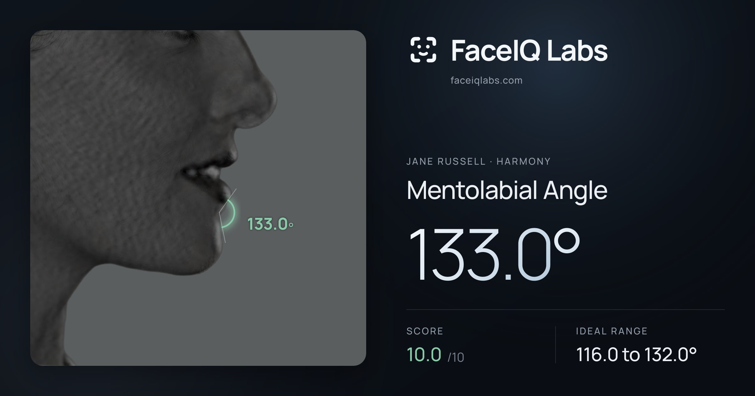 Jane Russell Mentolabial Angle: 133.0°, drawn on the photo