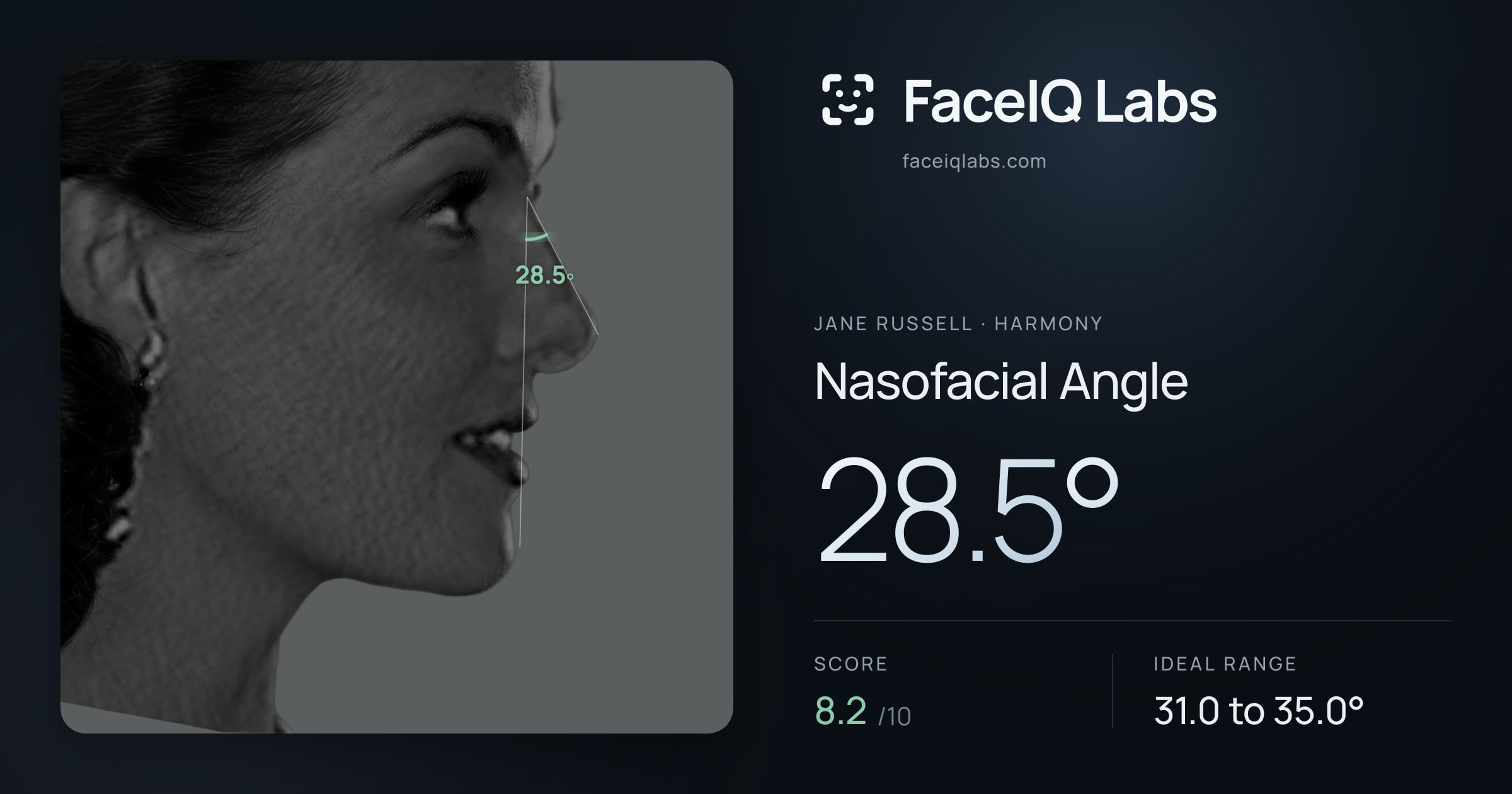 Jane Russell Nasofacial Angle: 28.5°, drawn on the photo