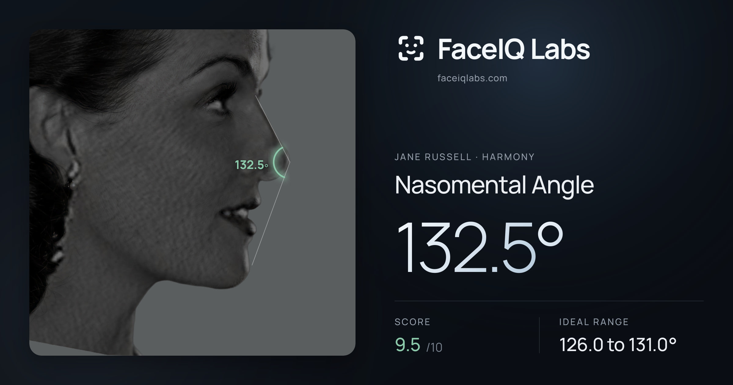 Jane Russell Nasomental Angle: 132.5°, drawn on the photo