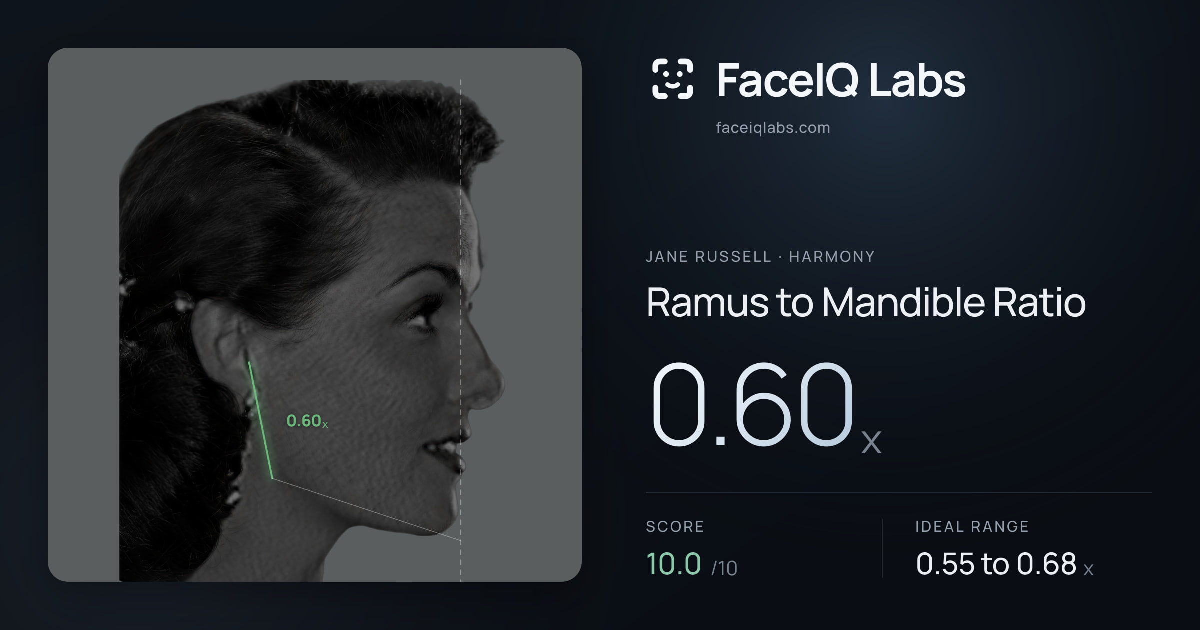 Jane Russell Ramus to Mandible Ratio: 0.60x, drawn on the photo