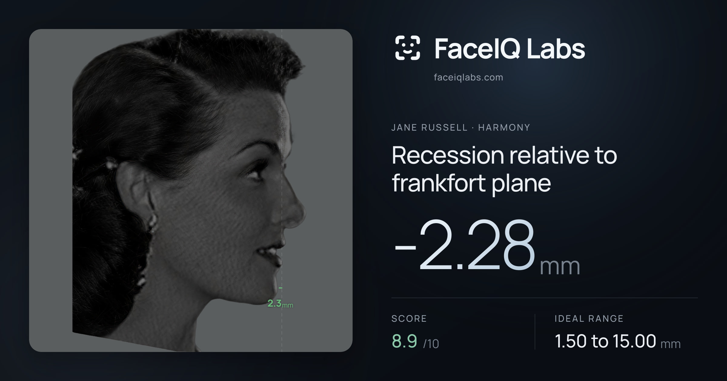 Jane Russell Recession relative to frankfort plane: -2.28mm, drawn on the photo